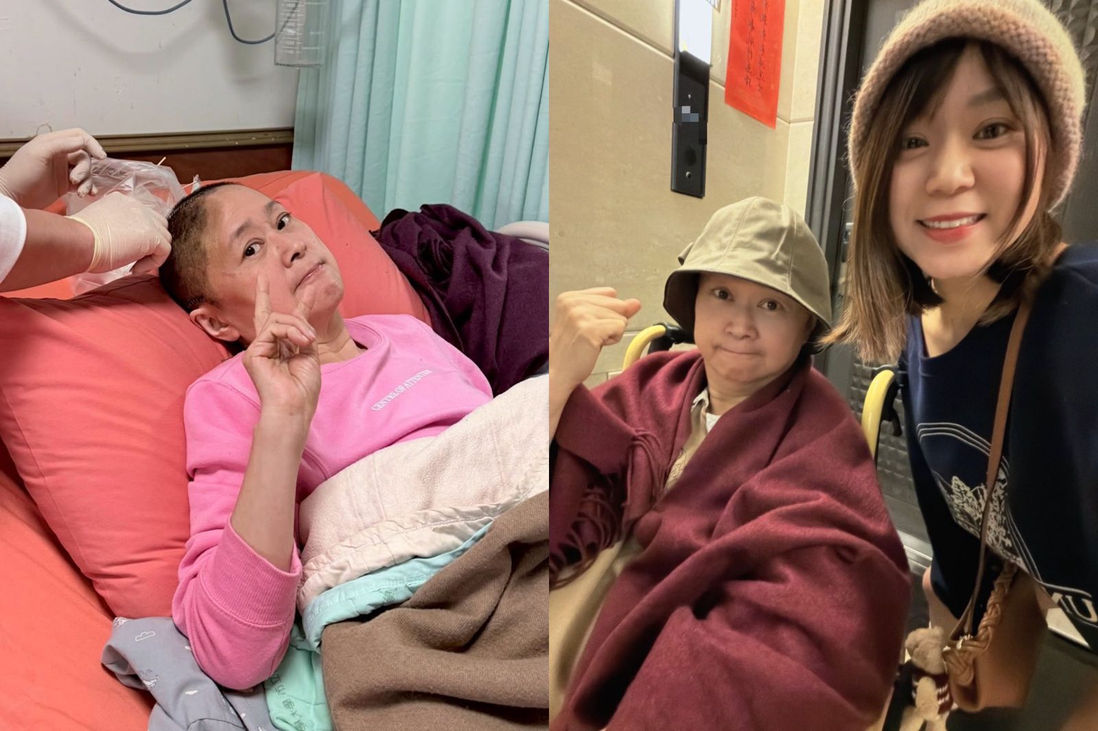 60歲王月驚吐動開顱手術!震撼病床照曝光 頭蓋骨少一塊「每口呼吸都困難」