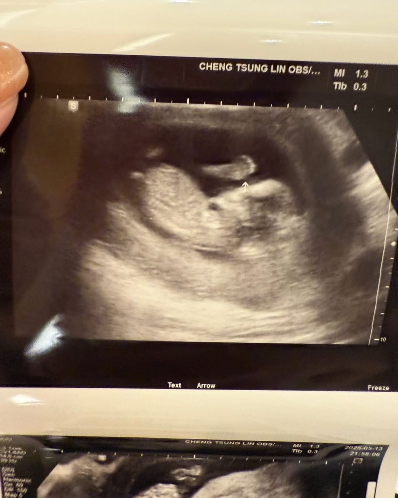 玉兔曬出寶寶的超音波照。翻攝玉兔IG