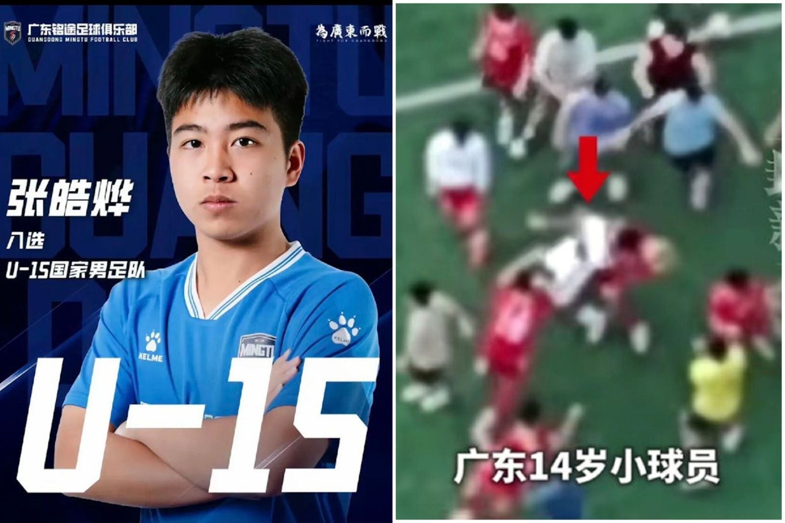 交流賽變「少林足球格鬥戰」!中國14歲小將慘被成人隊圍毆 踢爆下體