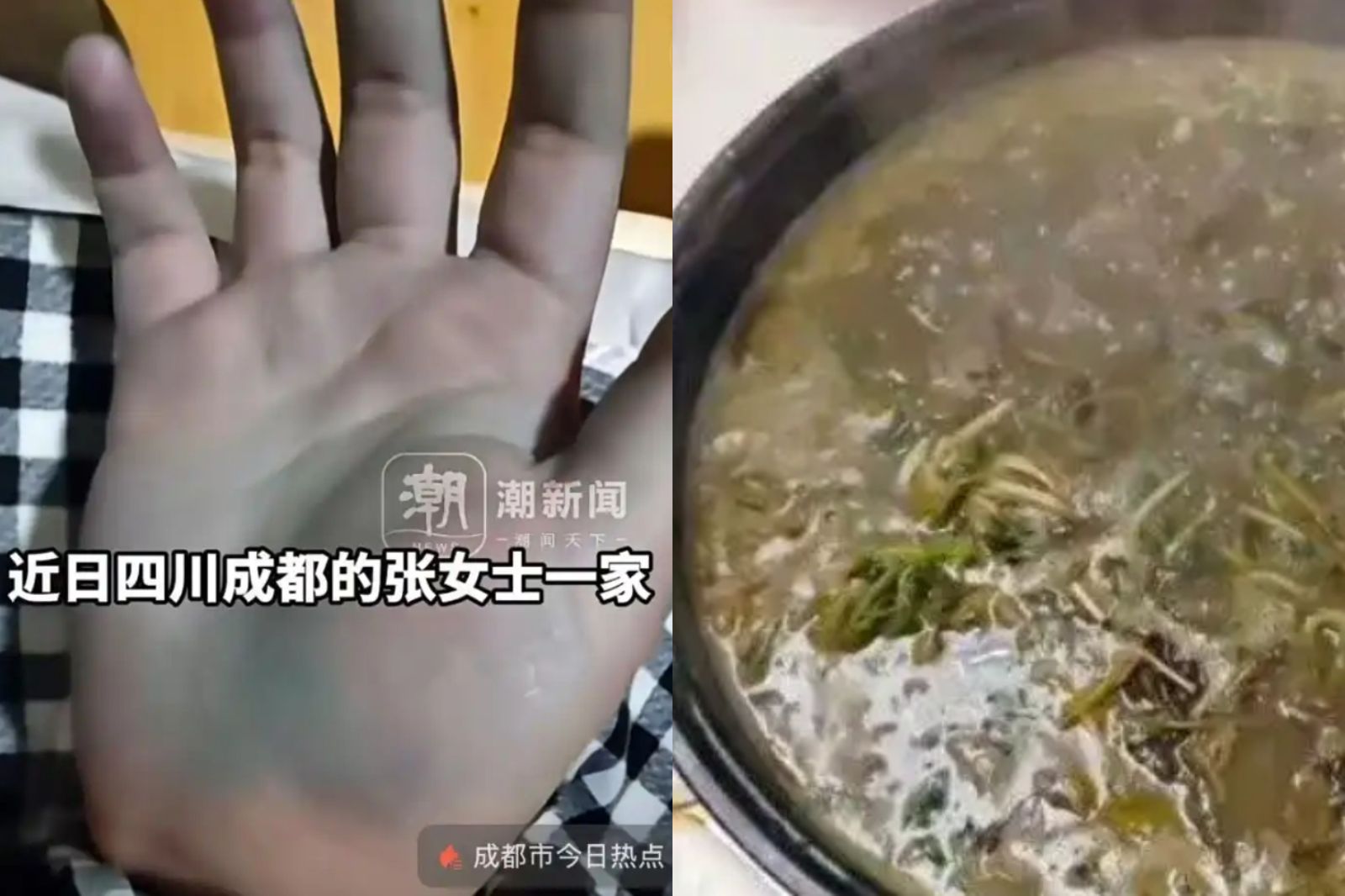 在家DIY「網紅美食」　4人吃完後「手變藍色」還上吐下瀉