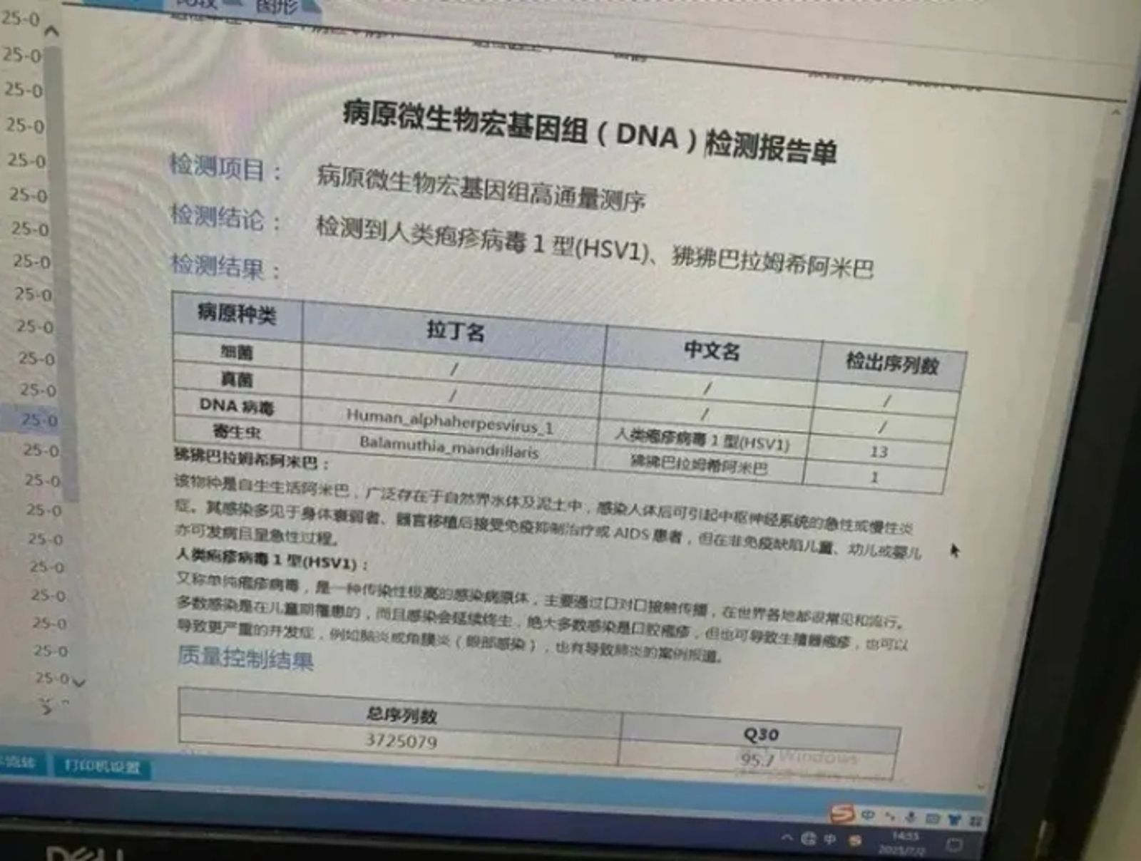 中國安徽一名男童確診感染「食腦蟲」。圖／翻攝自網易