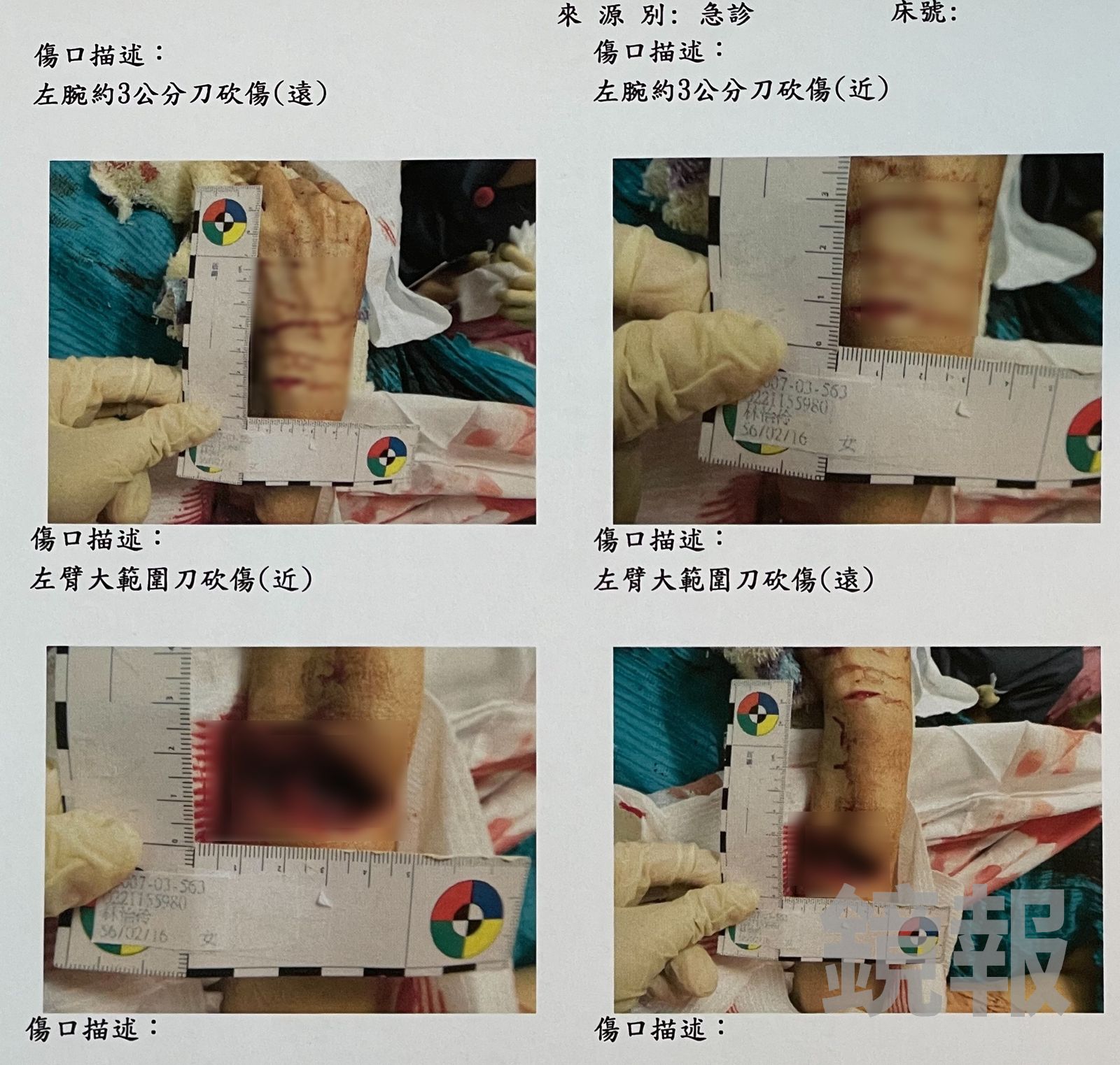 鶯歌街頭情殺/把前女友頭當西瓜剖半狠砍 被害人傷勢曝光!連8刀頭蓋骨裂、雙手骨折斷筋