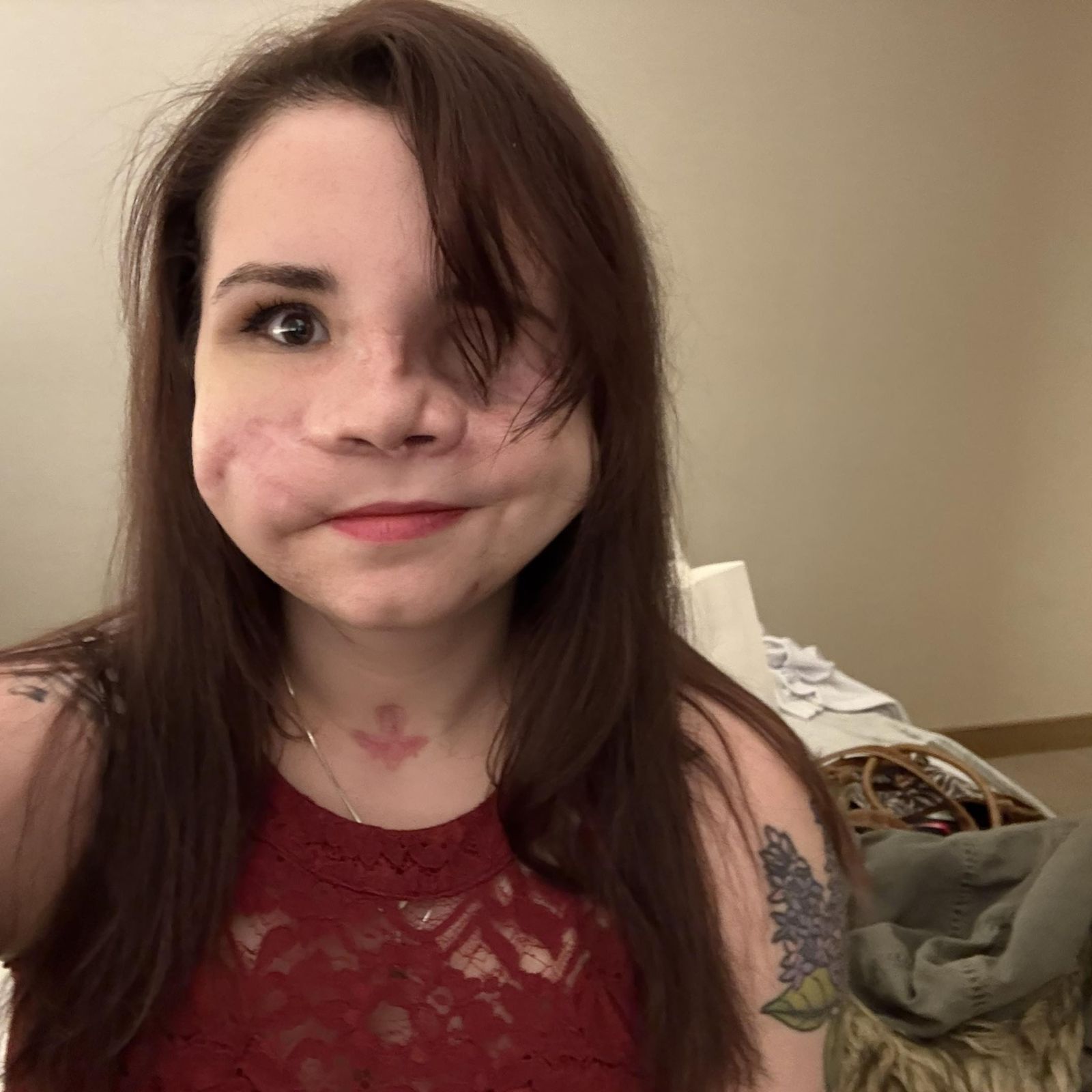 艾梅迪7年內接受了37次手術。圖／翻攝自當事人FB