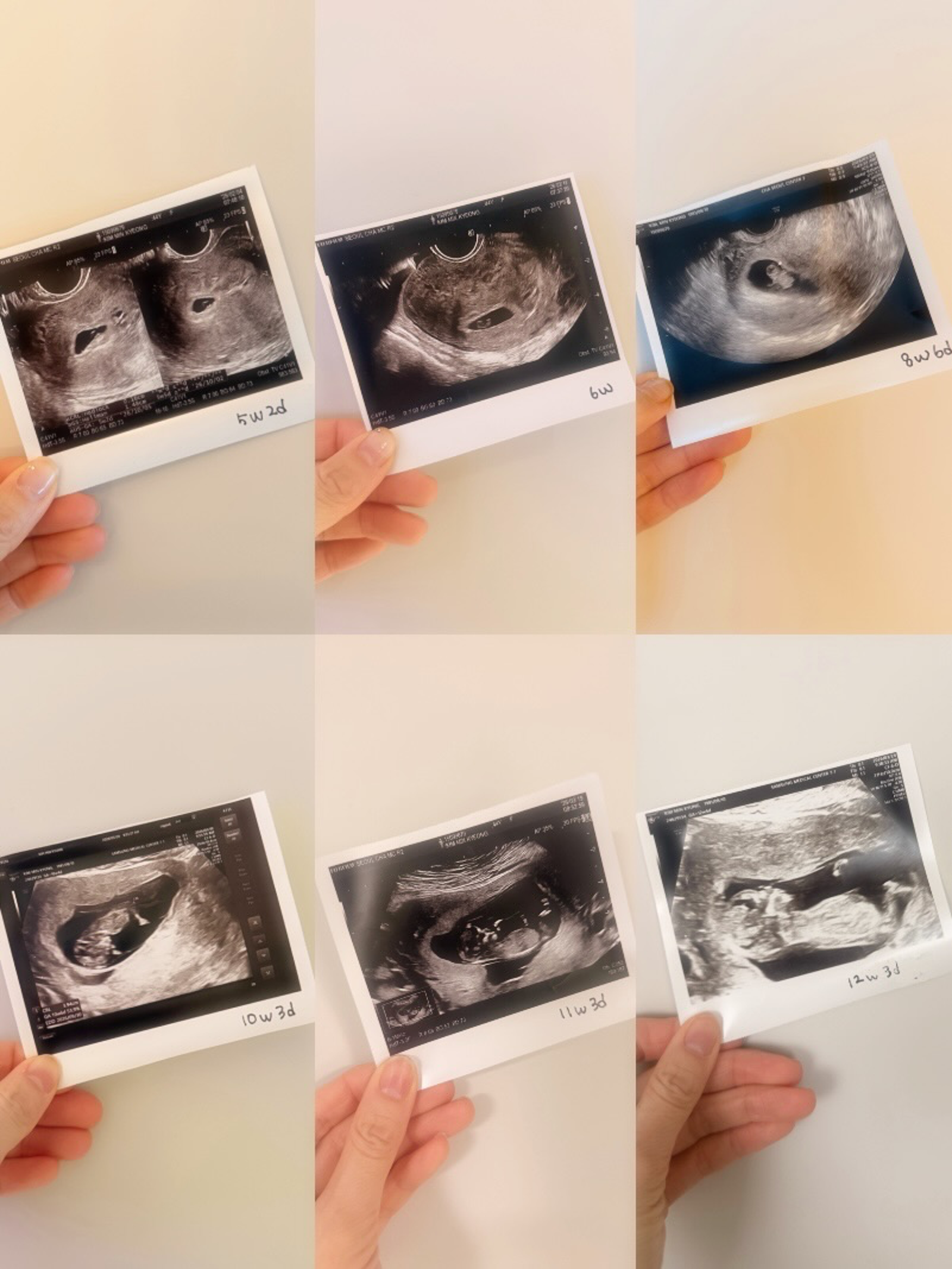 金玟鏡透過超音波照片，記錄寶寶的成長。翻攝IG@_minkyungkim_
