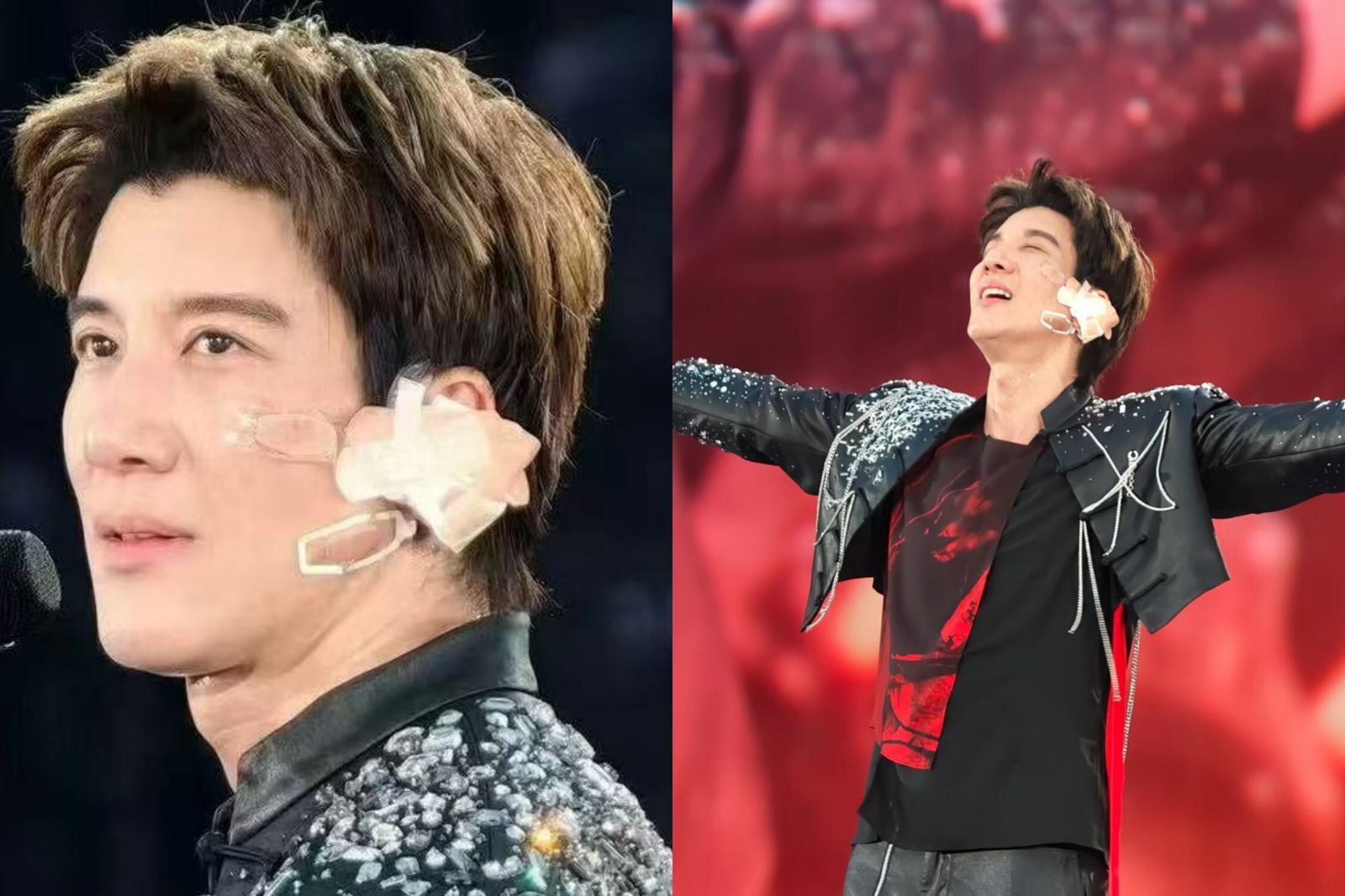 王力宏舞台重摔左臉掛彩!耳朵濺血包紮親揭傷勢狀況 自嘲「像MMA選手」