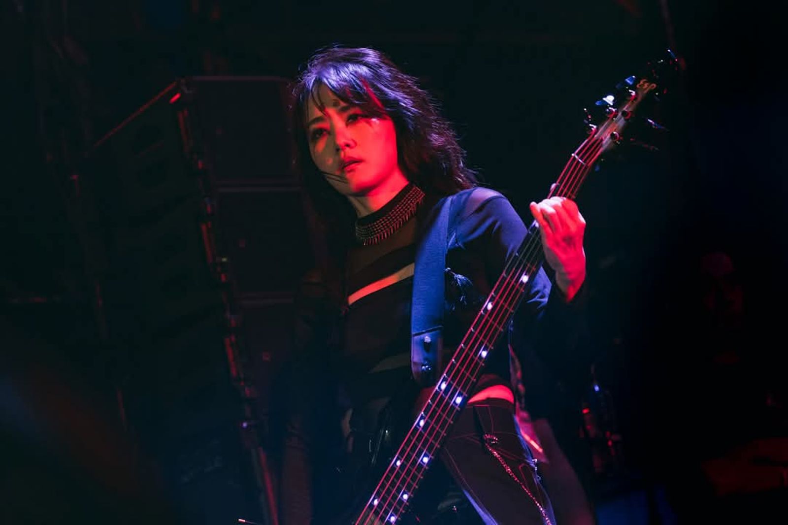 閃靈樂團Freddy妻患罕見腦部疾病　Doris發文親吐病況