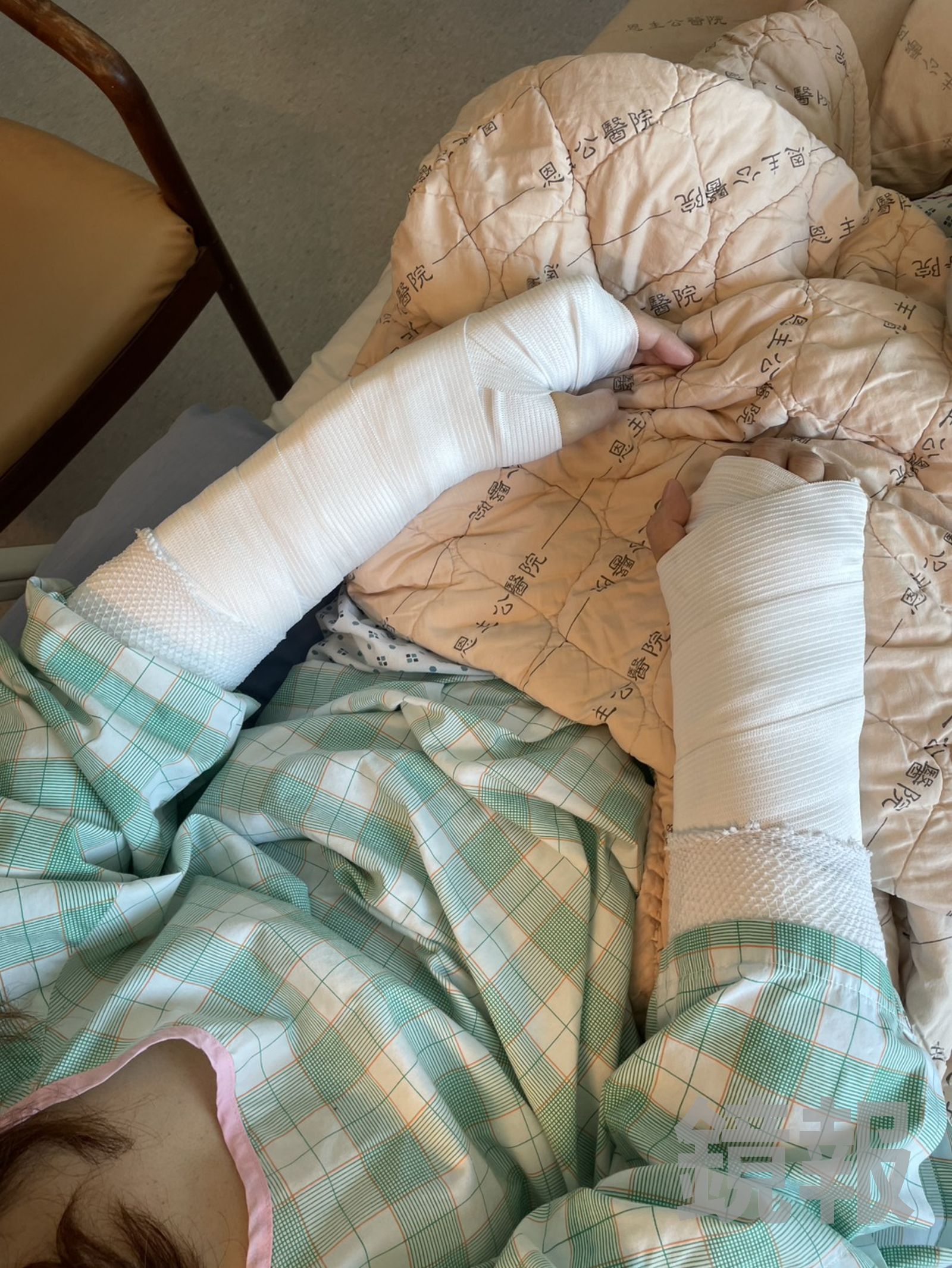 被害人目前雙手都打上石膏,醫生評估至少得休養半年以上。