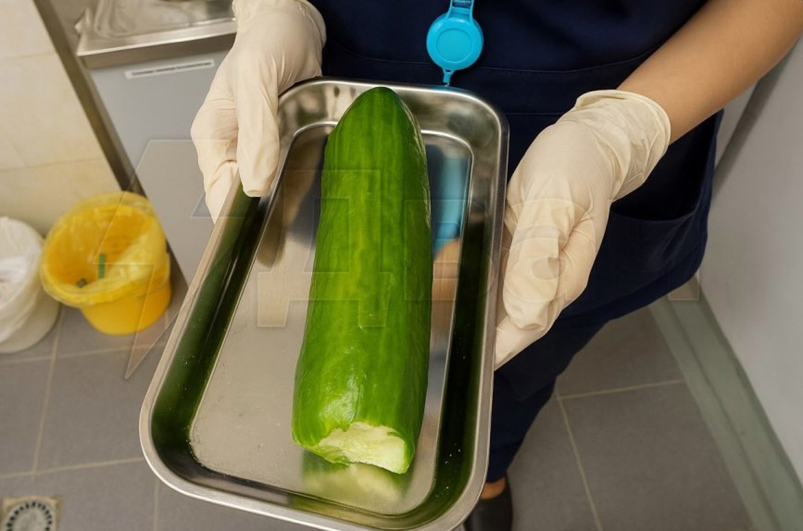 樂極生悲！21歲正妹「肛門卡超巨黃瓜」痛到送醫…取出竟見「被咬過了」