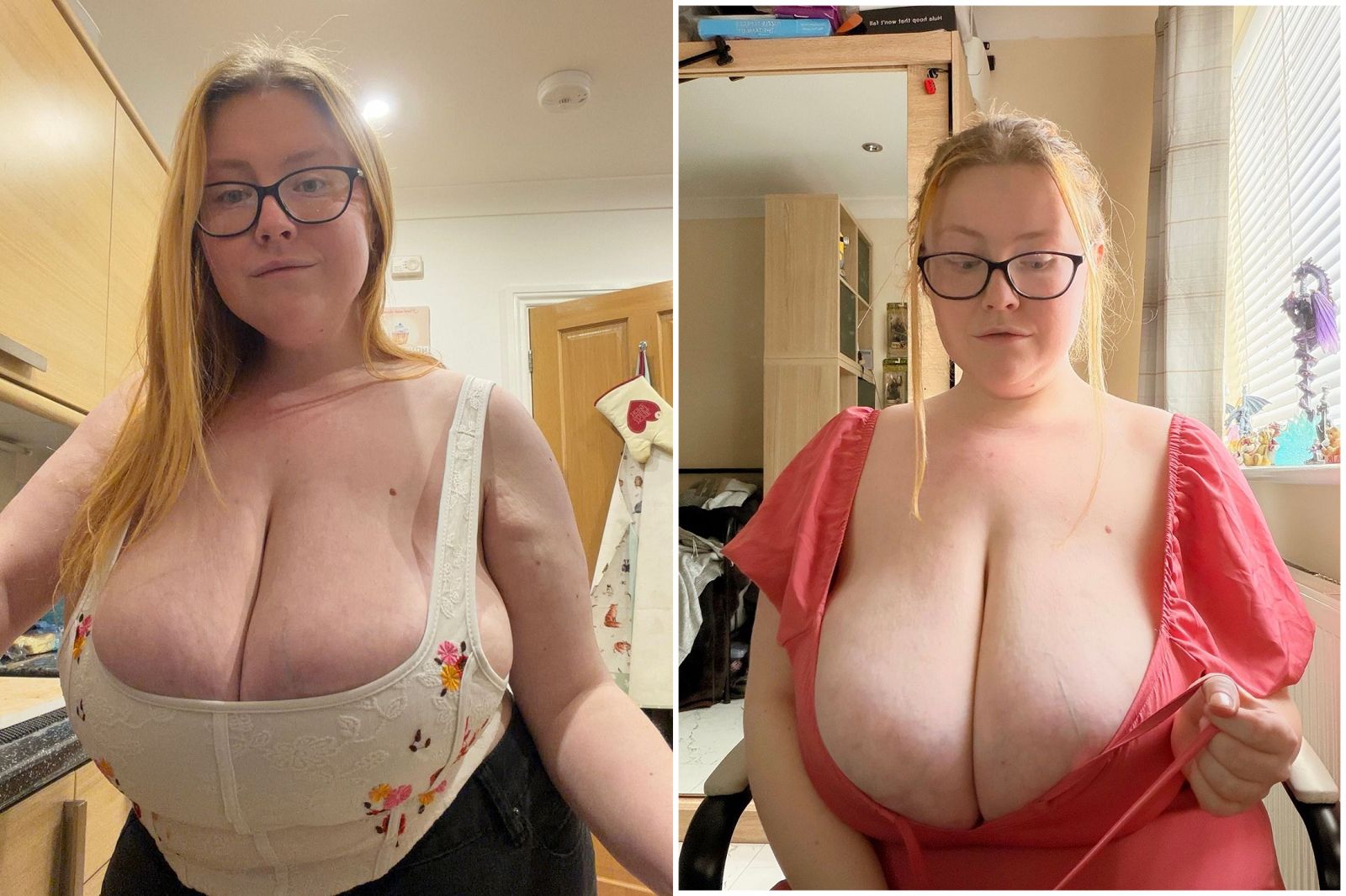 Meta脫窗？她患巨乳症拍照無修圖　竟被IG判AI假圖