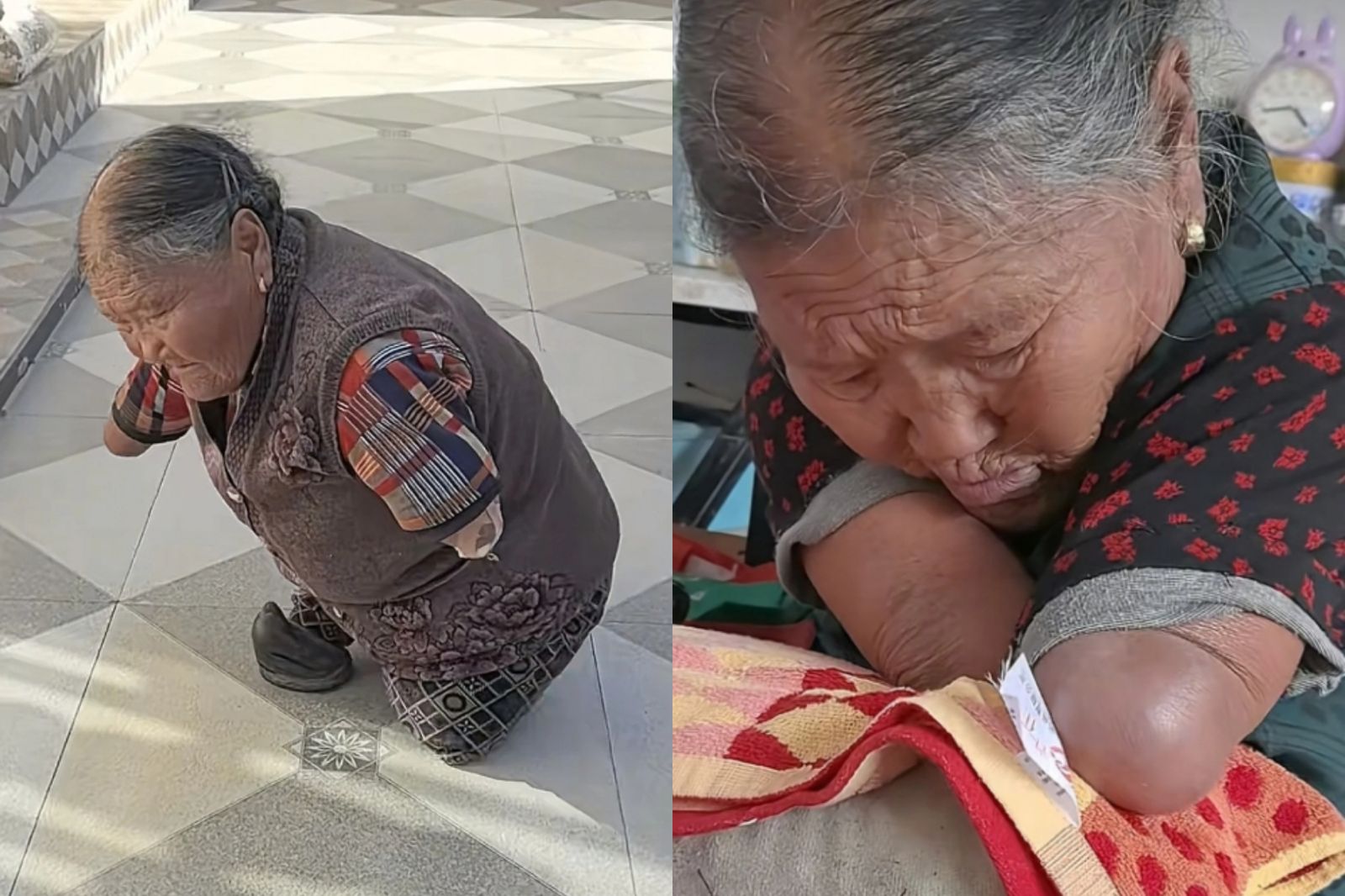 81歲嬤先天沒四肢!「靠嘴縫衣、手肘夾筷」養3兒女 小兒子:她從沒抱怨