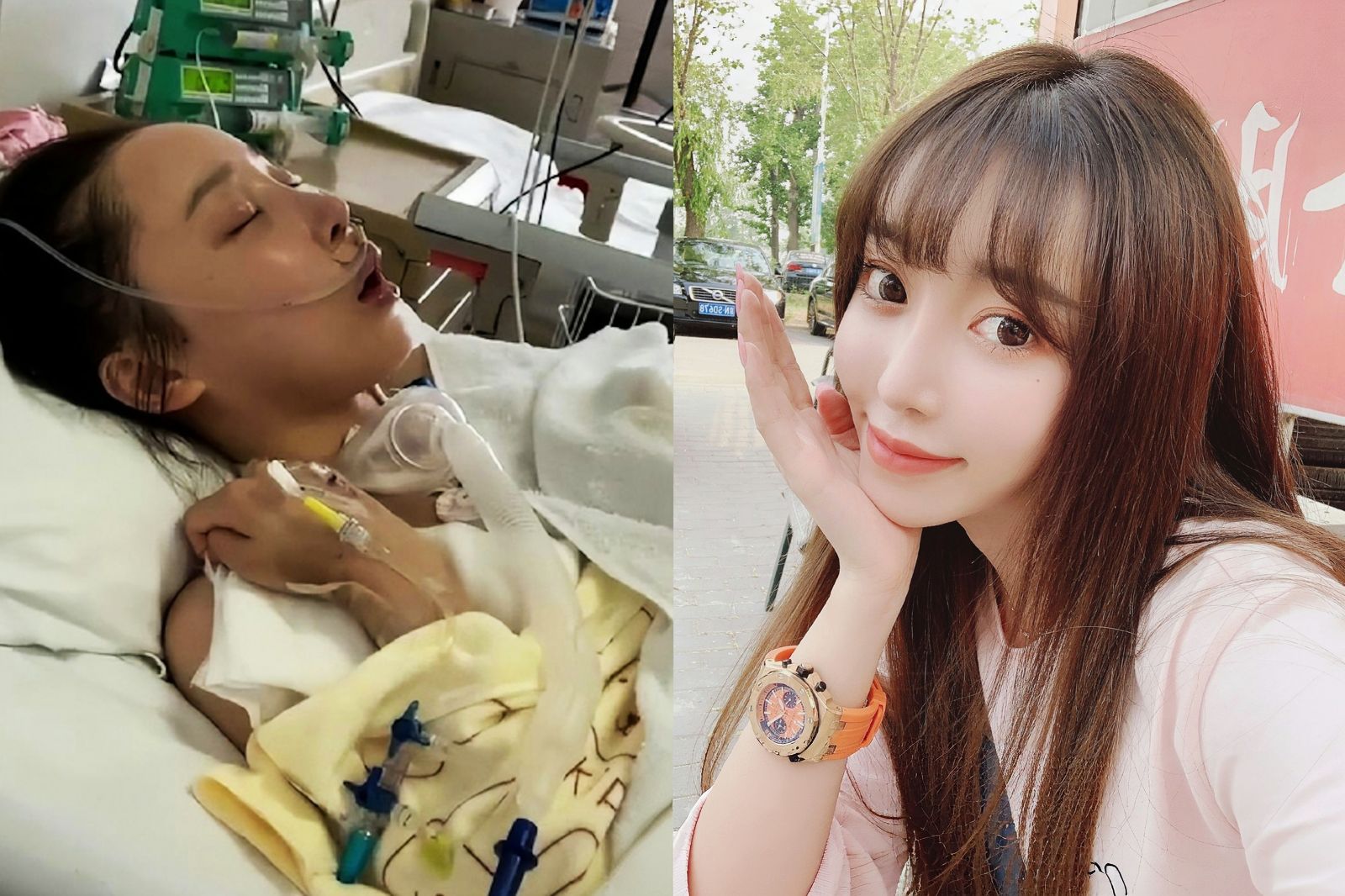 29歲女星心臟驟停成植物人!昏迷3個月奇蹟甦醒 重返片場竟被嗆「躺平得了」