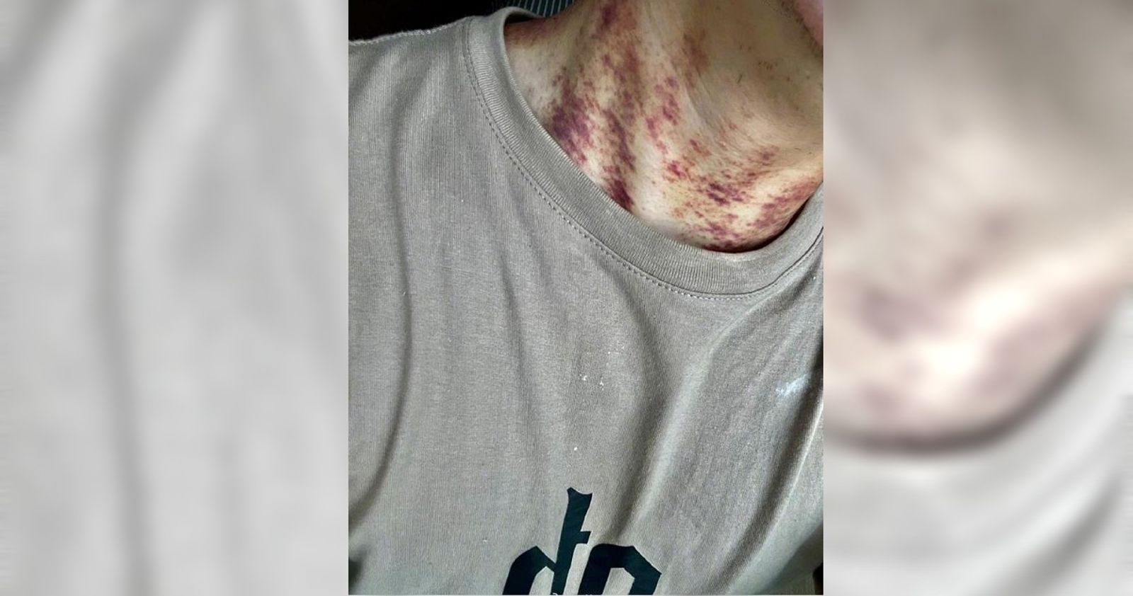 月租24萬房子！住進去後「全身紅疹」罹多病　超恐怖原因曝光