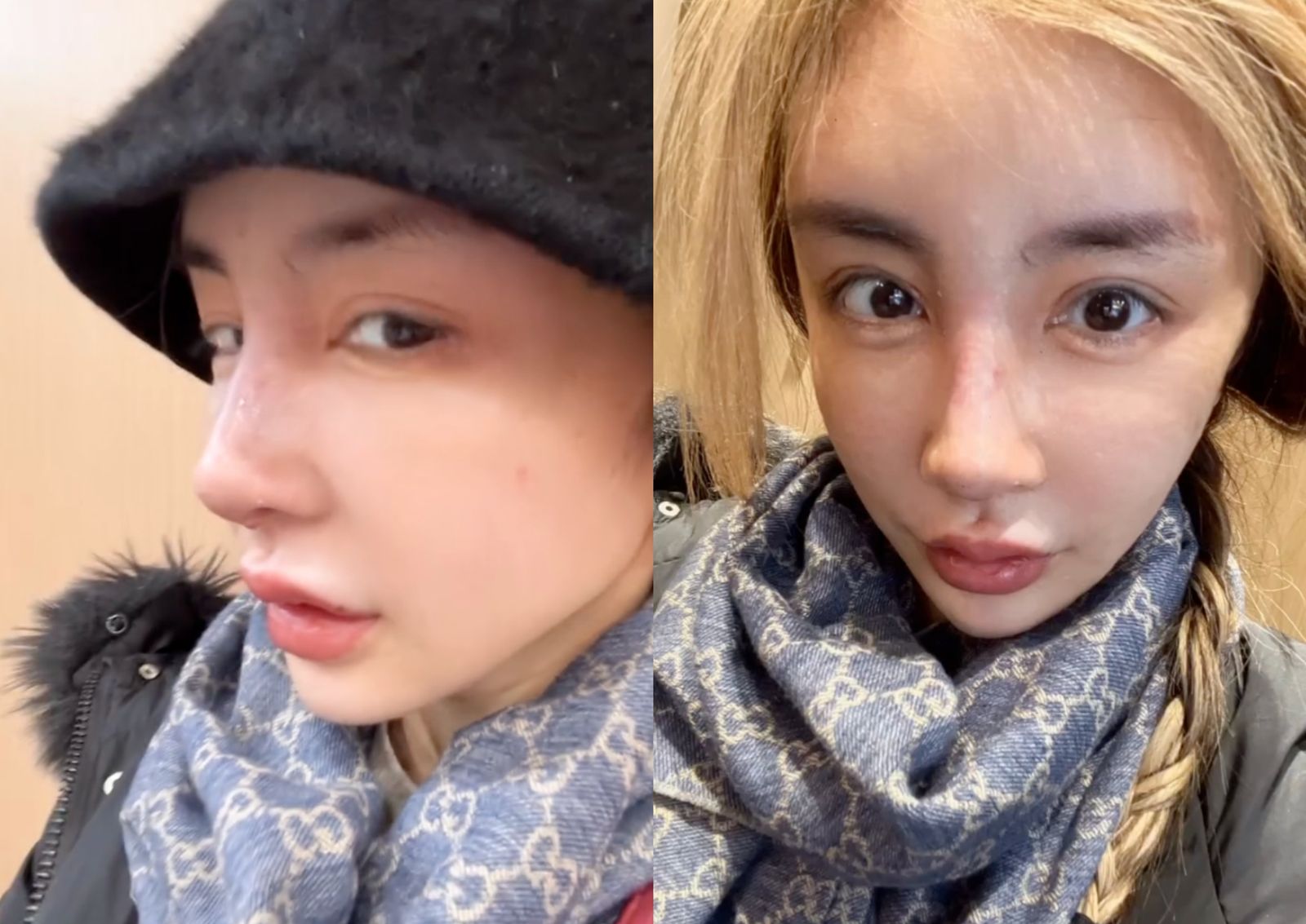 雪碧曬出新鼻子。翻攝IG@sprite0719ss