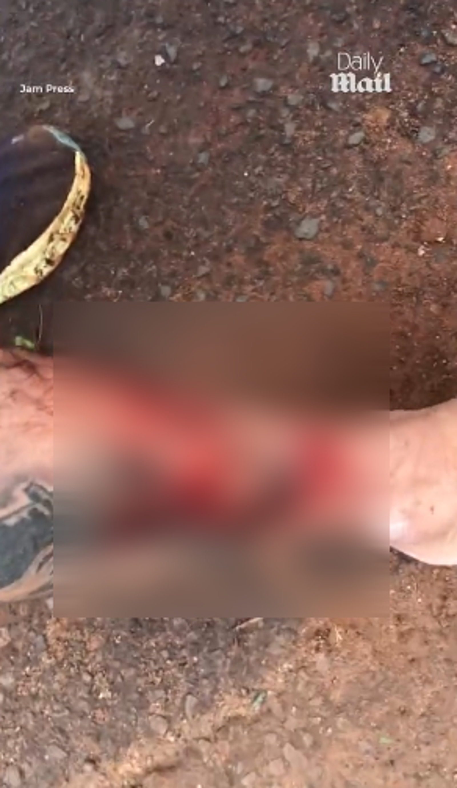 查維斯的小腿被比特犬咬傷。圖／翻自《每日郵報》