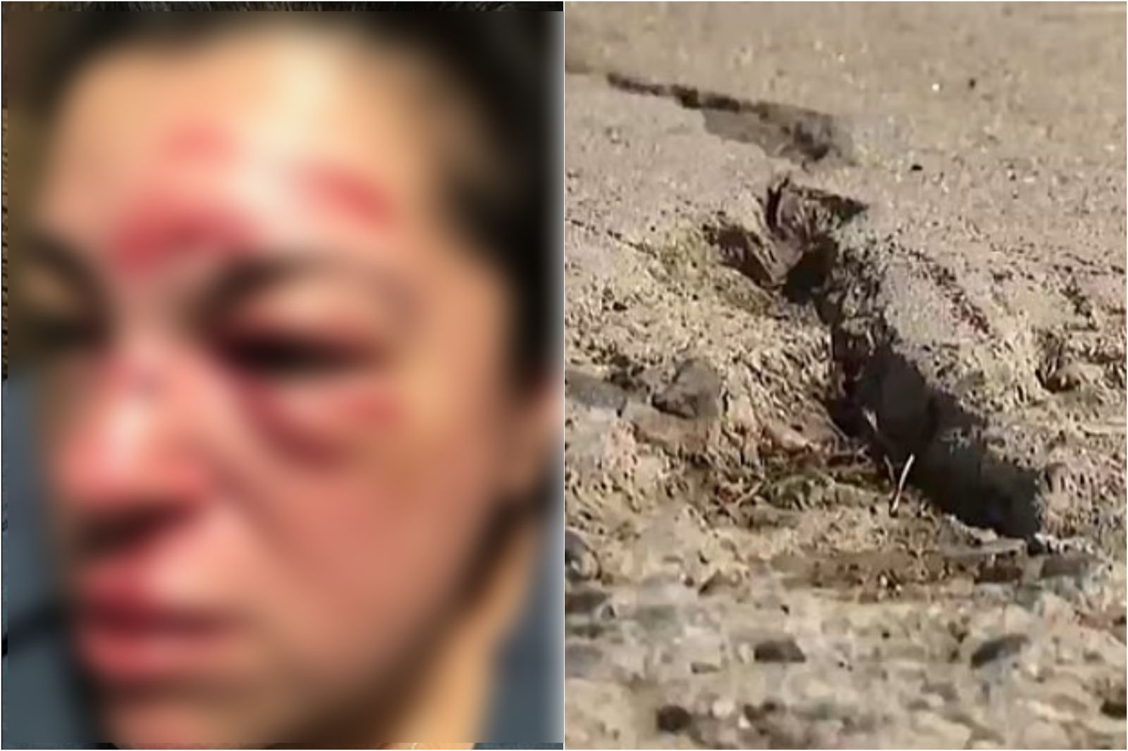 女師人行道散步被絆倒！獲2.3億賠償　「這原因」成該市最常見索賠糾紛　
