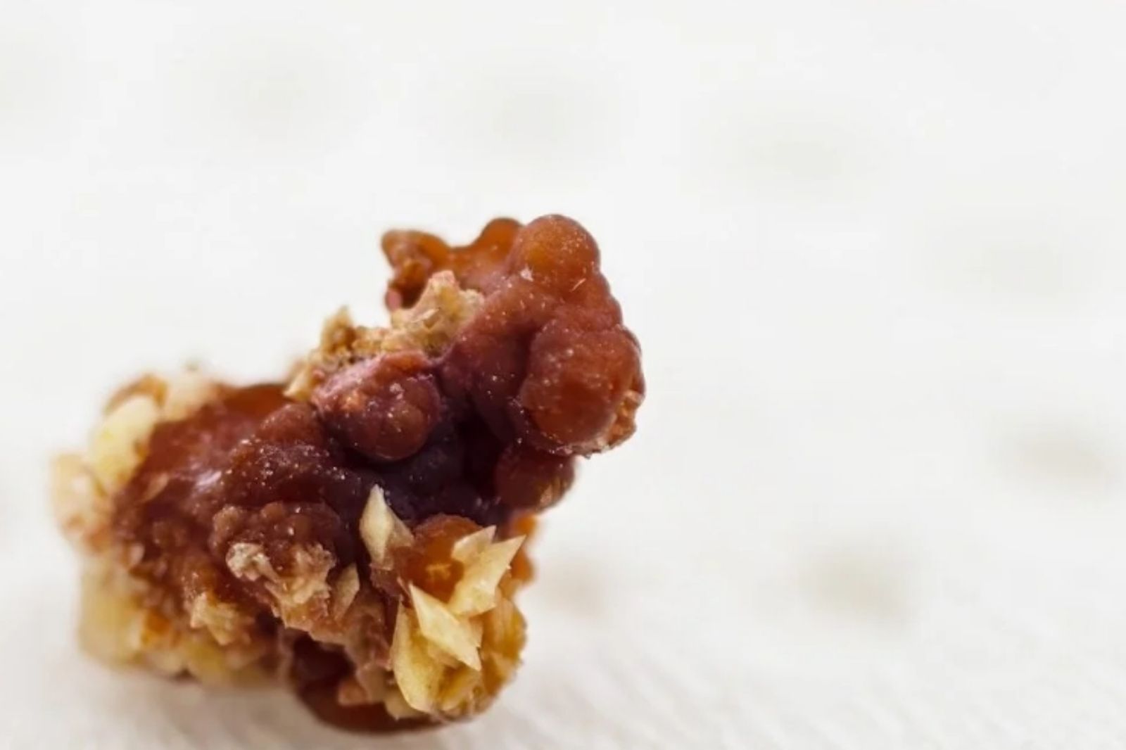 以為是寶石！竊賊闖空門偷走「寶盒」　住戶傻眼：是我的腎結石