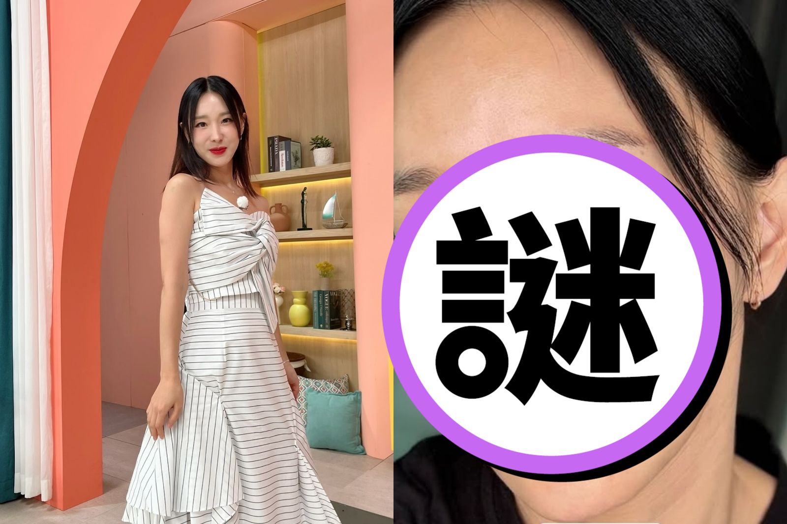 46歲女星不再遮了！縮人中後自信曬素顏　親吐「4公分」心結