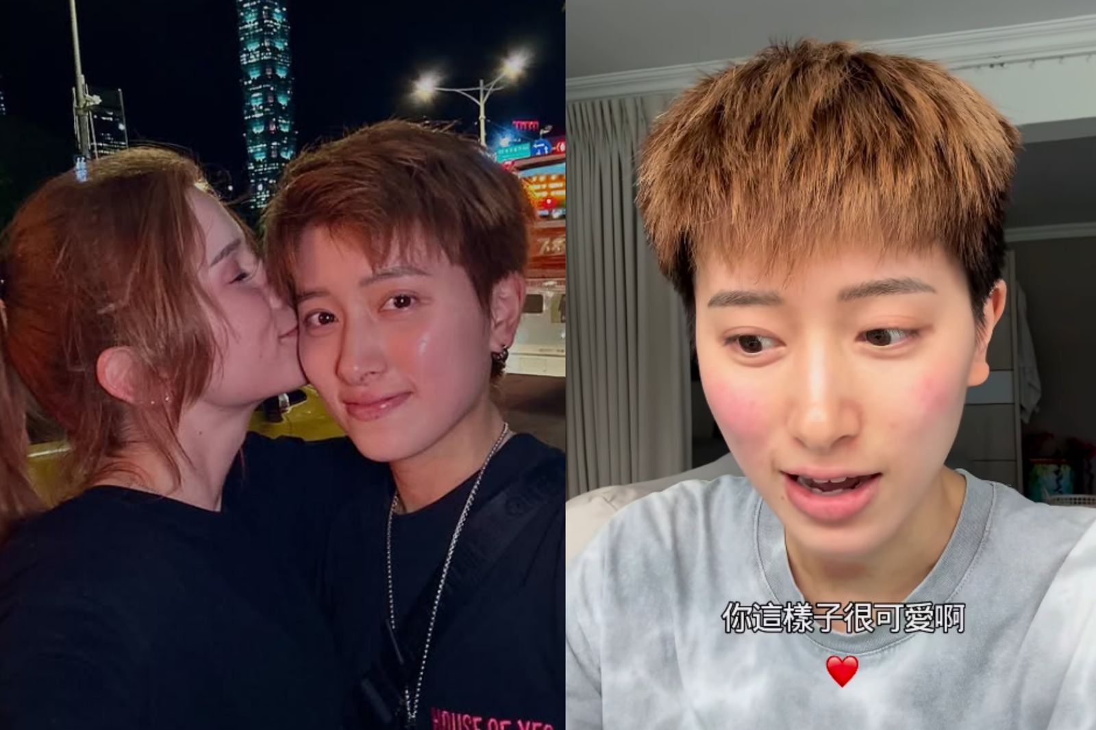 鄭靚歆揭皮膚炎心路歷程　曾痛苦到想解脫