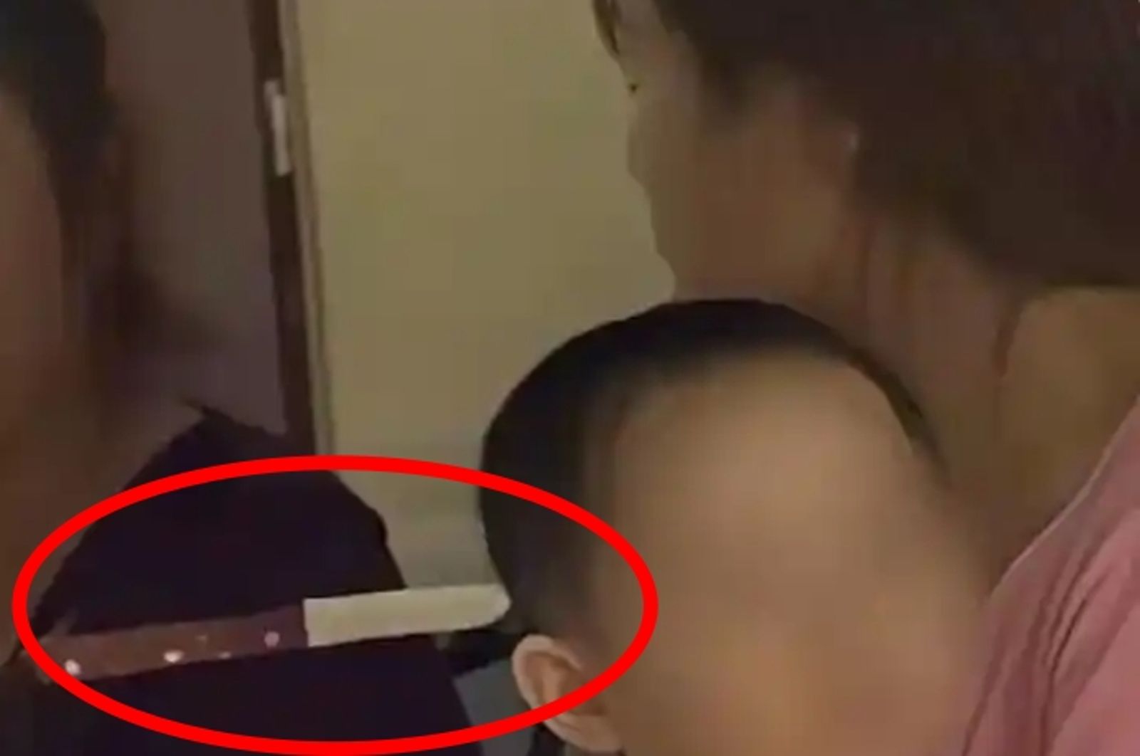 嚇壞！3歲女童「頭插15公分刀子」淡定走進醫院　醫讚母「這件事」做對了