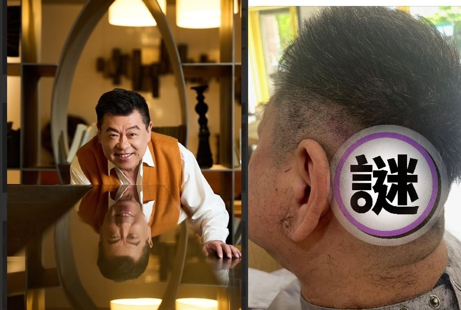 孫德榮檢查前夕驚見頭皮真貌　點名別用這款洗髮精