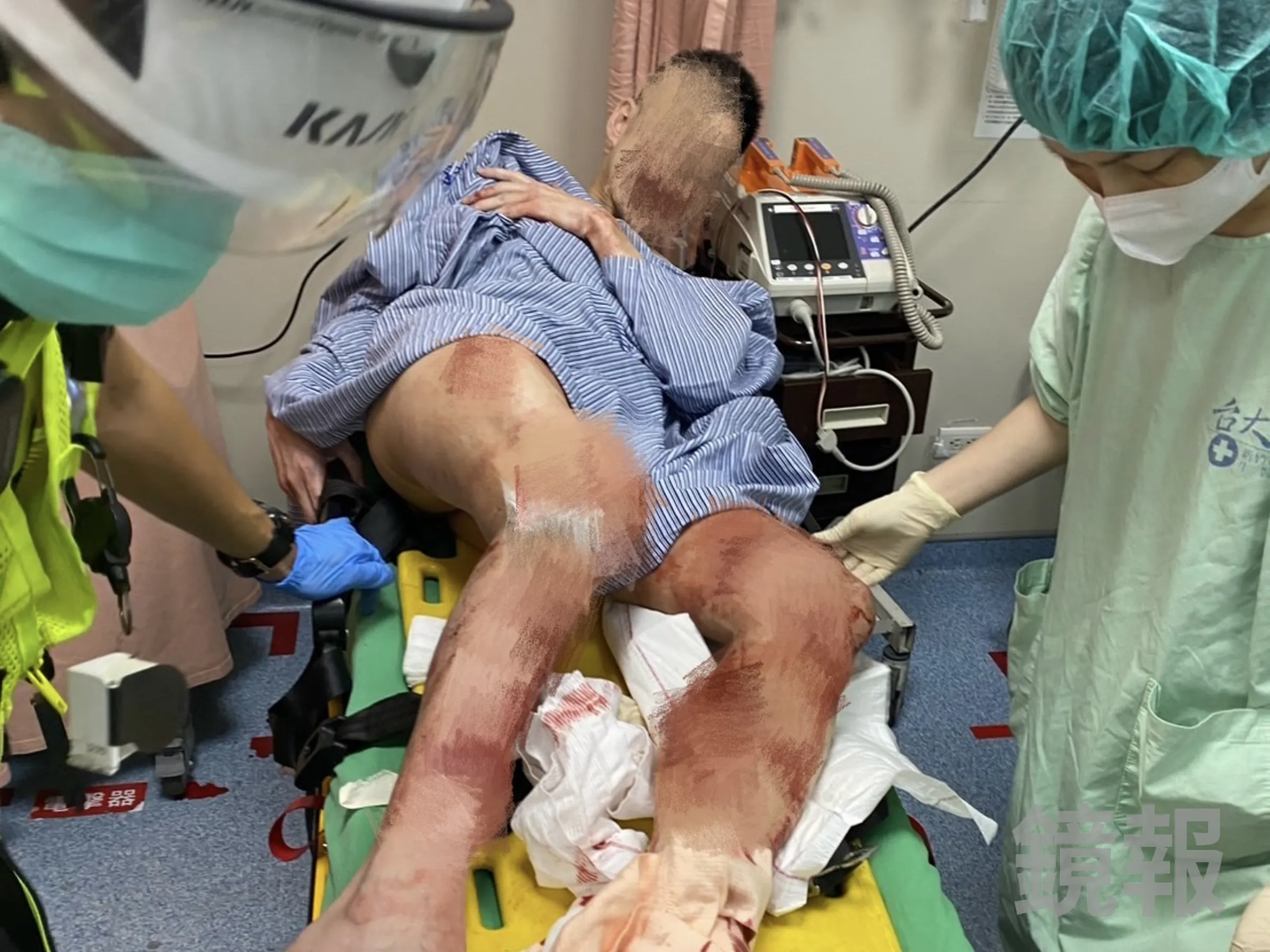 出院了!陽明交大教授狠殺連襟50刀中彈送醫 戒護11天今坐輪椅移送