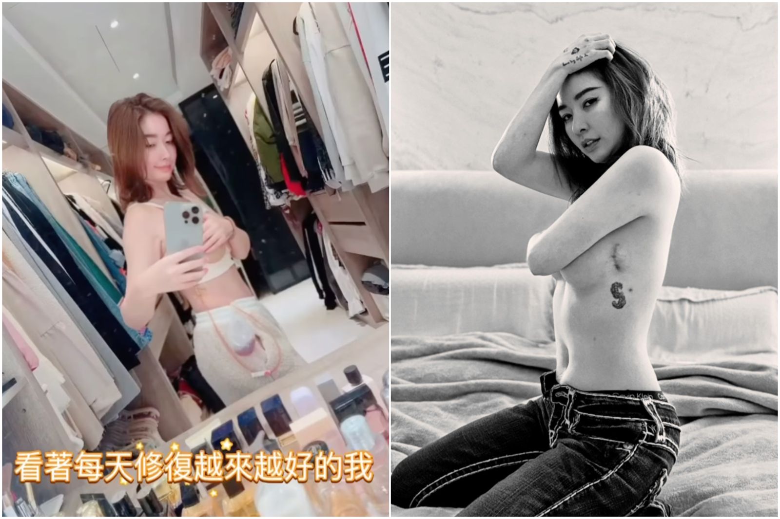 許維恩公開11小時切乳術後真實狀態！掛引流管扭翹臀　老公王家梁陪住院畫面曝光