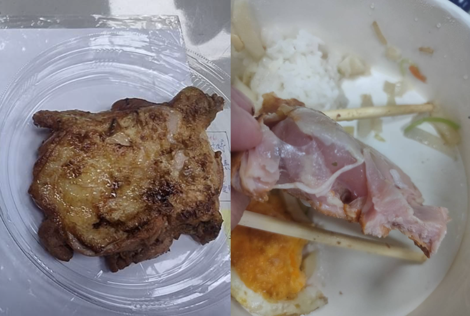 民眾吃雞腿便當吃到送急診，網友全看傻。圖／翻攝自爆料公社