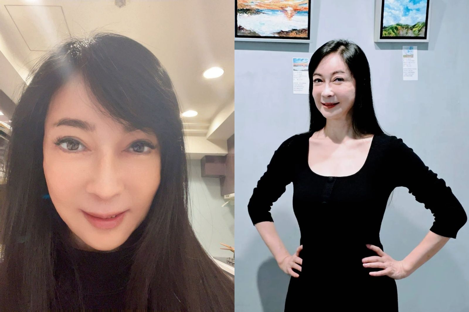 癌細胞擴散肝肺腹膜!59歲「整型女王」直腸癌四期惡化 顧婕淚喊怕家人送最後一程