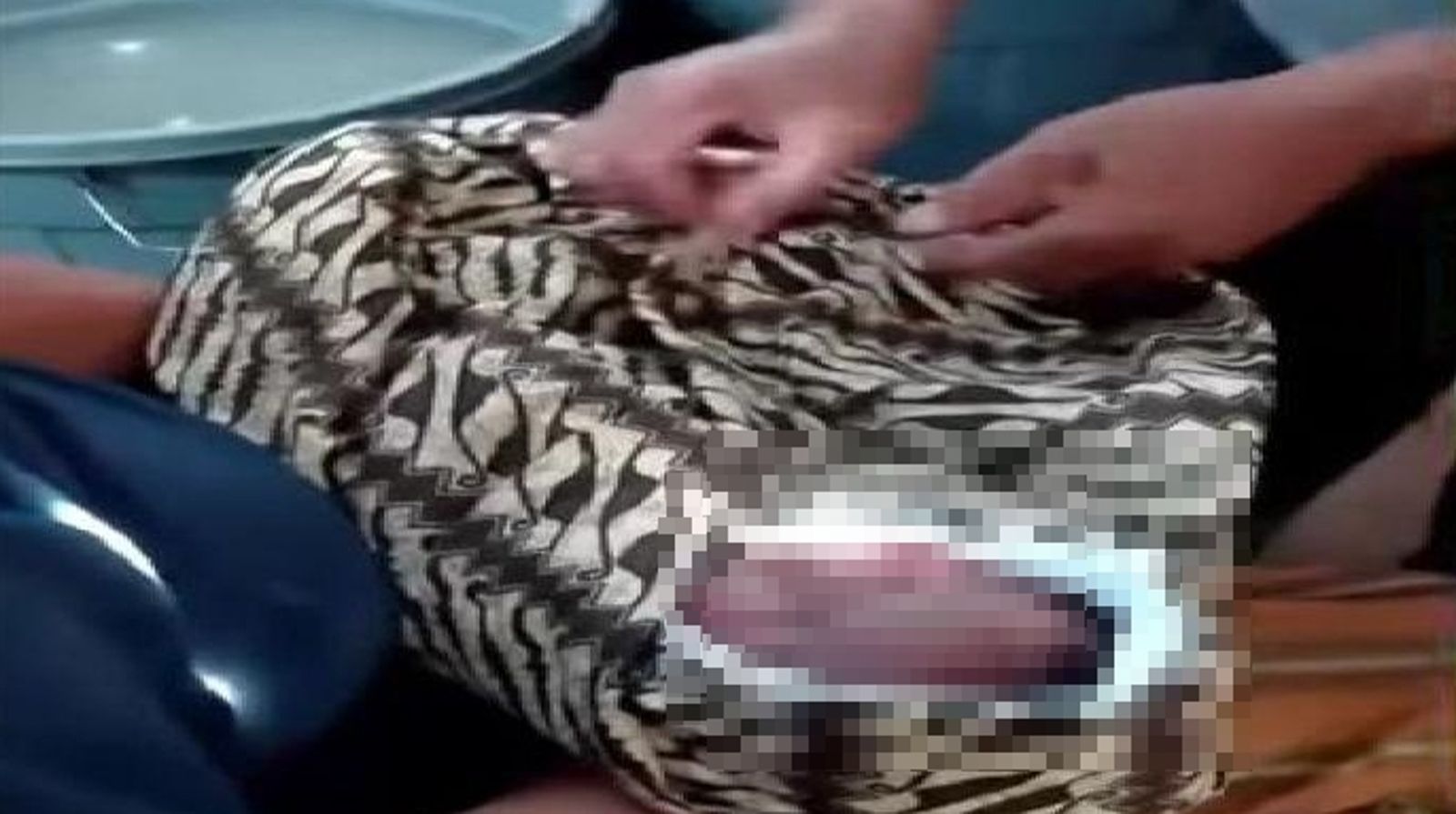 母產4.2kg寶寶驚見「頭顱掉地板」身體卡子宮內!父抱屍痛哭…官方回應撇醫療疏失