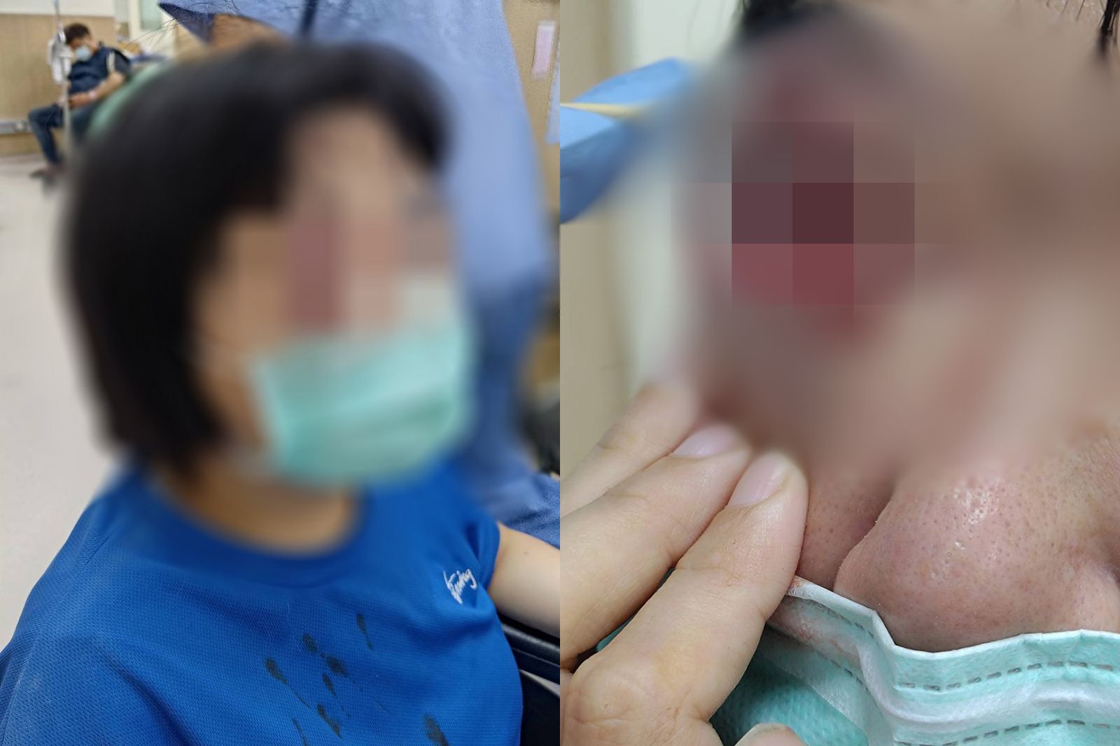 只是提醒「請回座位」!國一生暴怒折斷掃把 30歲女師護生慘遭刺眼恐失明