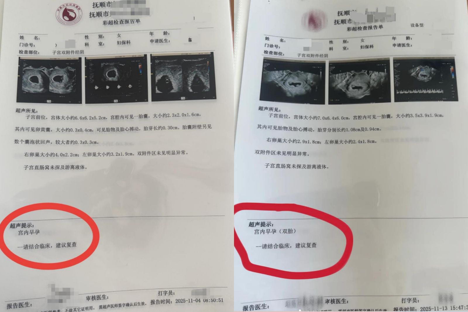 中國一名30歲女子去年11月4日首次進行產檢發現第1胎，13日第2次產檢發現第2胎。圖／翻攝自微博