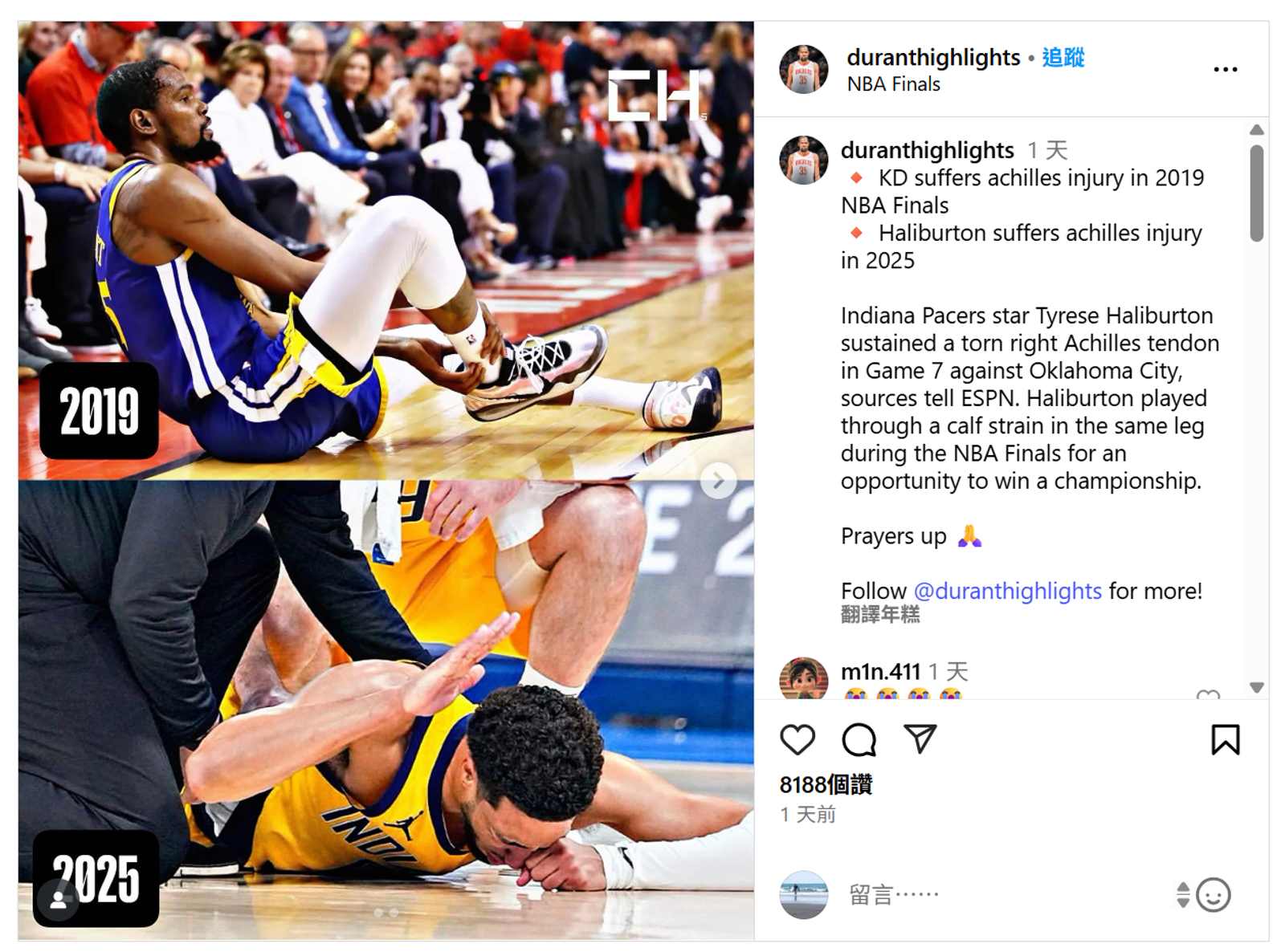 Haliburton的受傷,讓許多球迷想起2019年KD的遭遇。duranthighlights IG