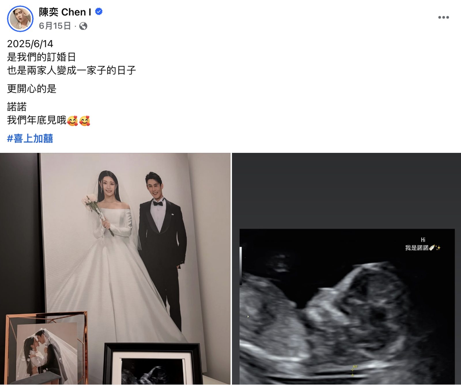 陳奕於6月訂婚，女兒小名叫「諾諾」。翻攝陳奕 Chen I  臉書