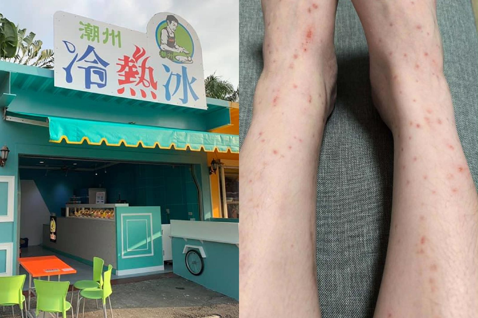 說「不要芋頭」還放!女遊客出紅疹過敏掛急診 怒控劍湖山店家卸責