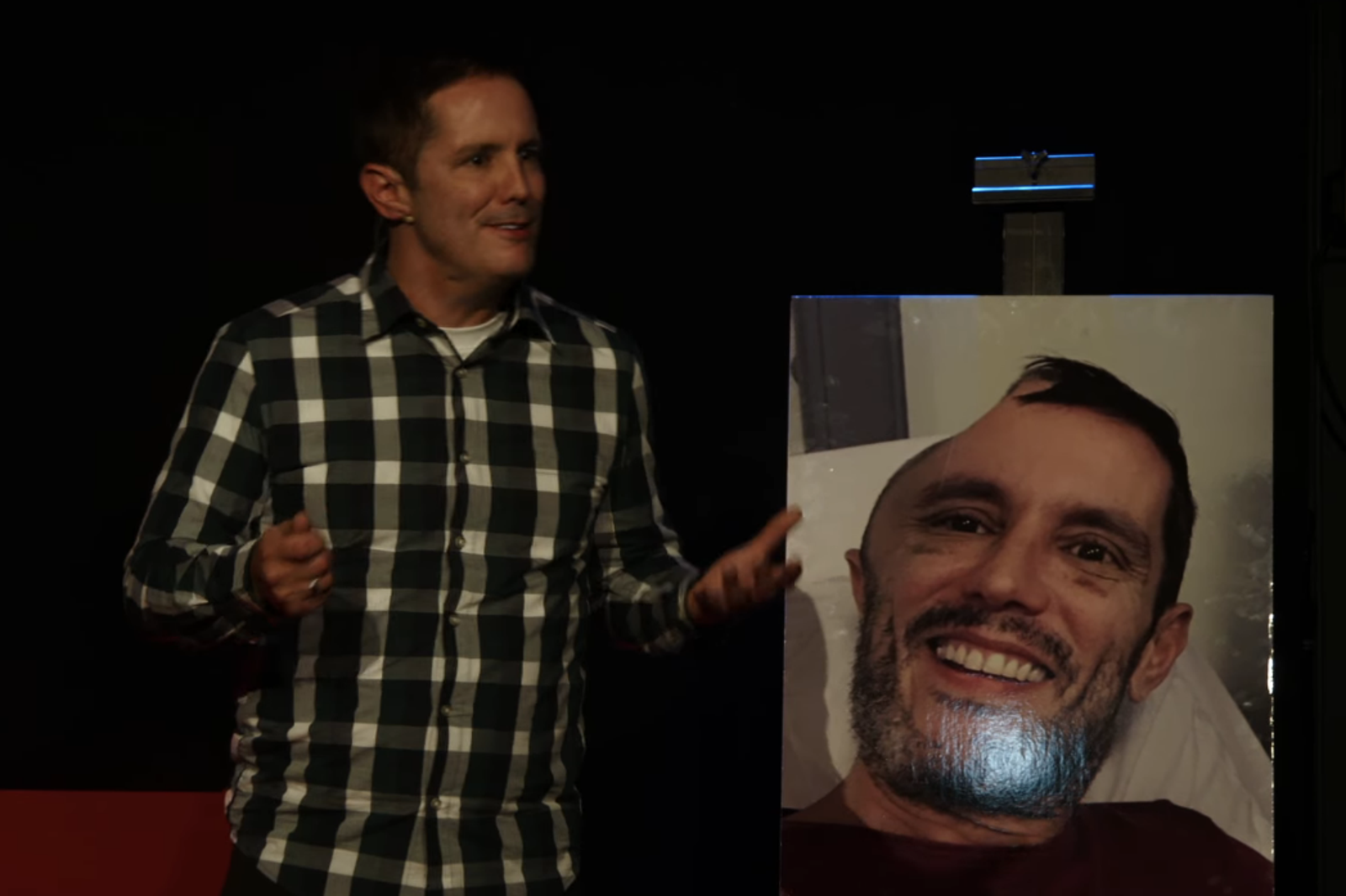 趕車摔倒送醫！醒來手摸大腦「半顆頭消失」
