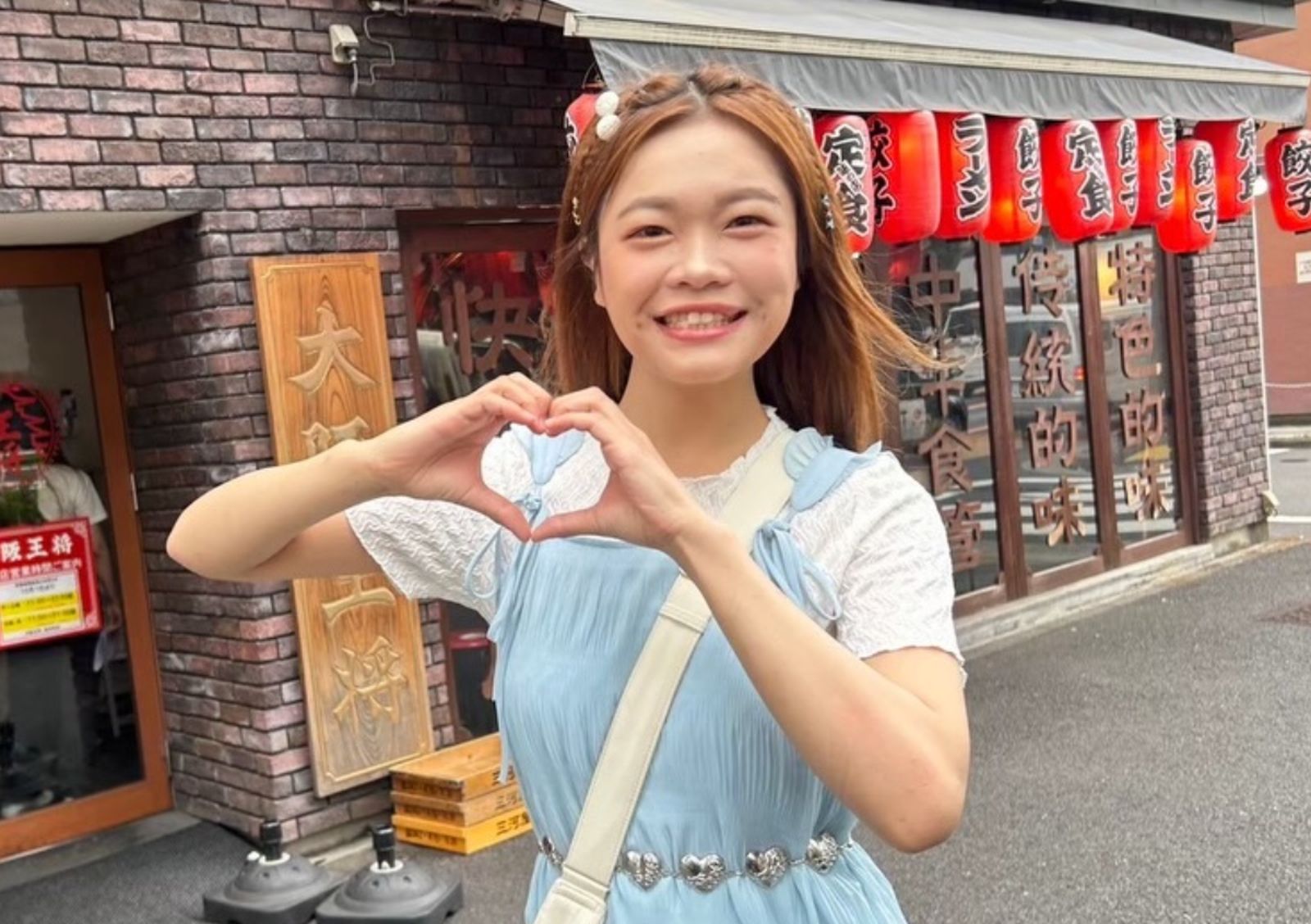 大胃王小慧胃有多大?「吃飽前後」CT照曝光 本人看完都嚇到:這是魯夫的胃