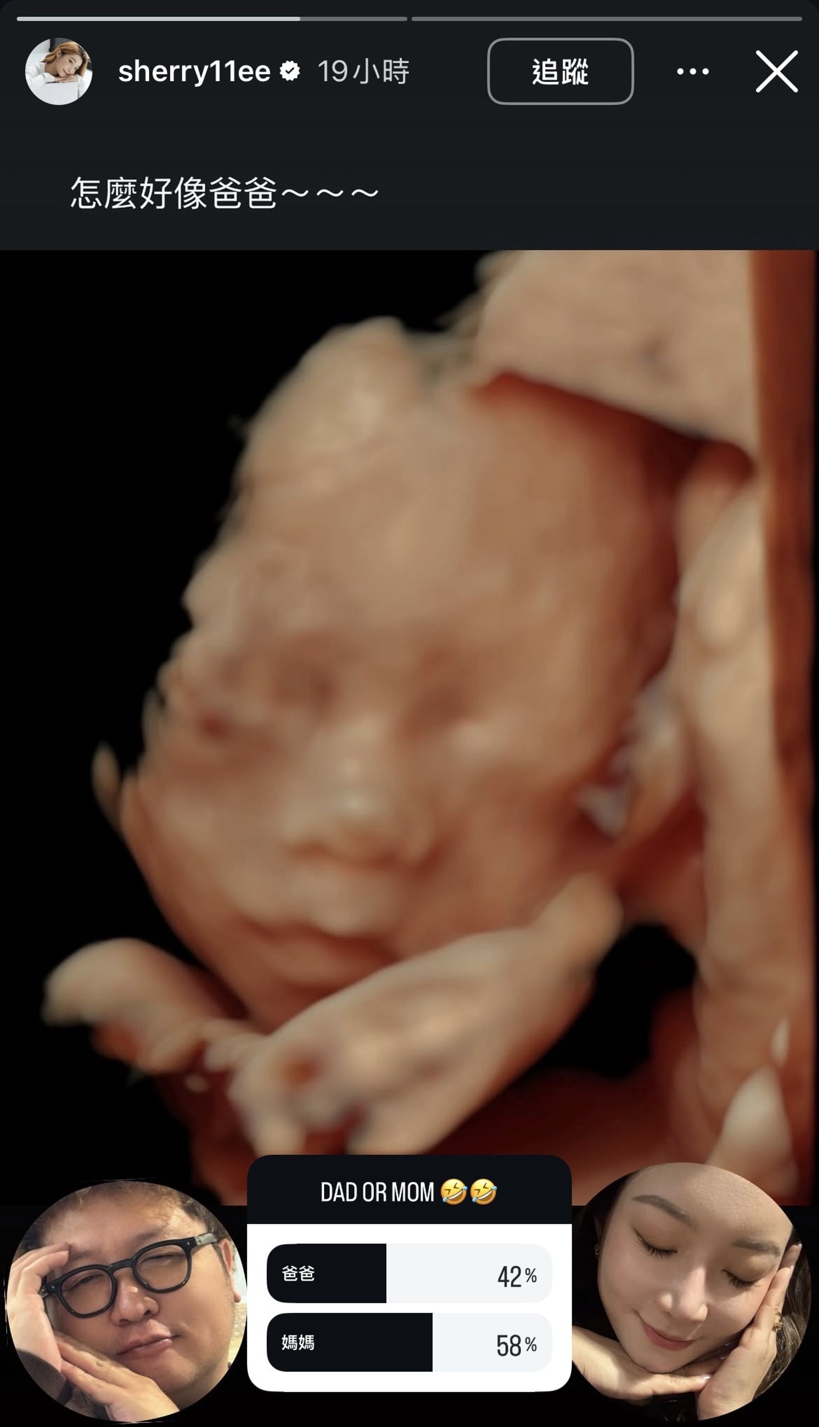 寶寶的超音波照曝光。翻攝IG@sherry11ee