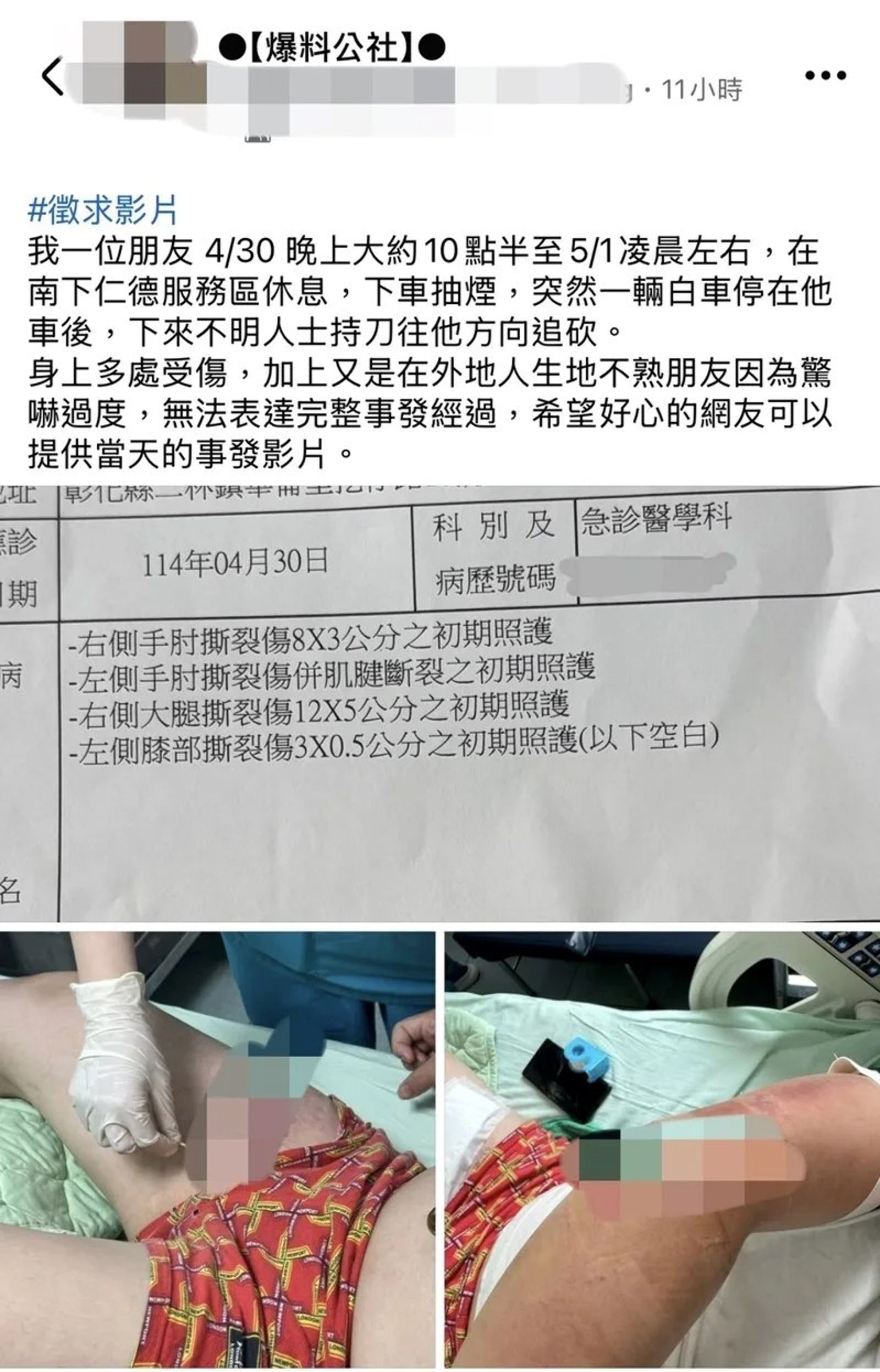 網爆料男子深夜在仁德休息站遭陌生人砍傷　警方：非隨機砍人