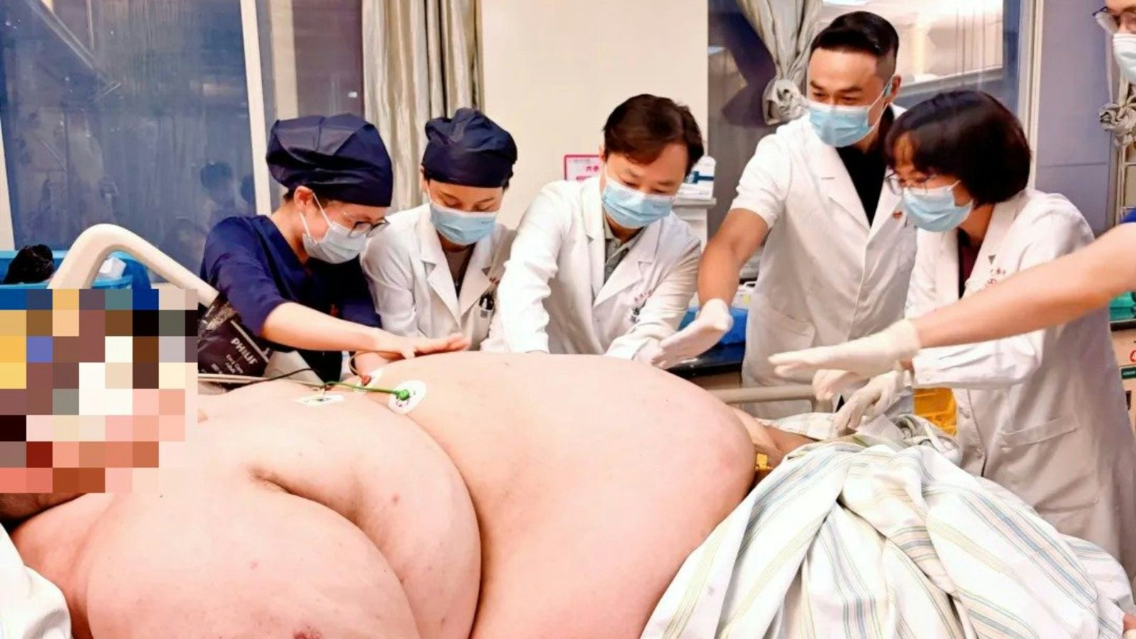 30歲男膨脹至317公斤器官衰竭!ICU住13天急救 「12位醫護合力抬」闖過鬼門關