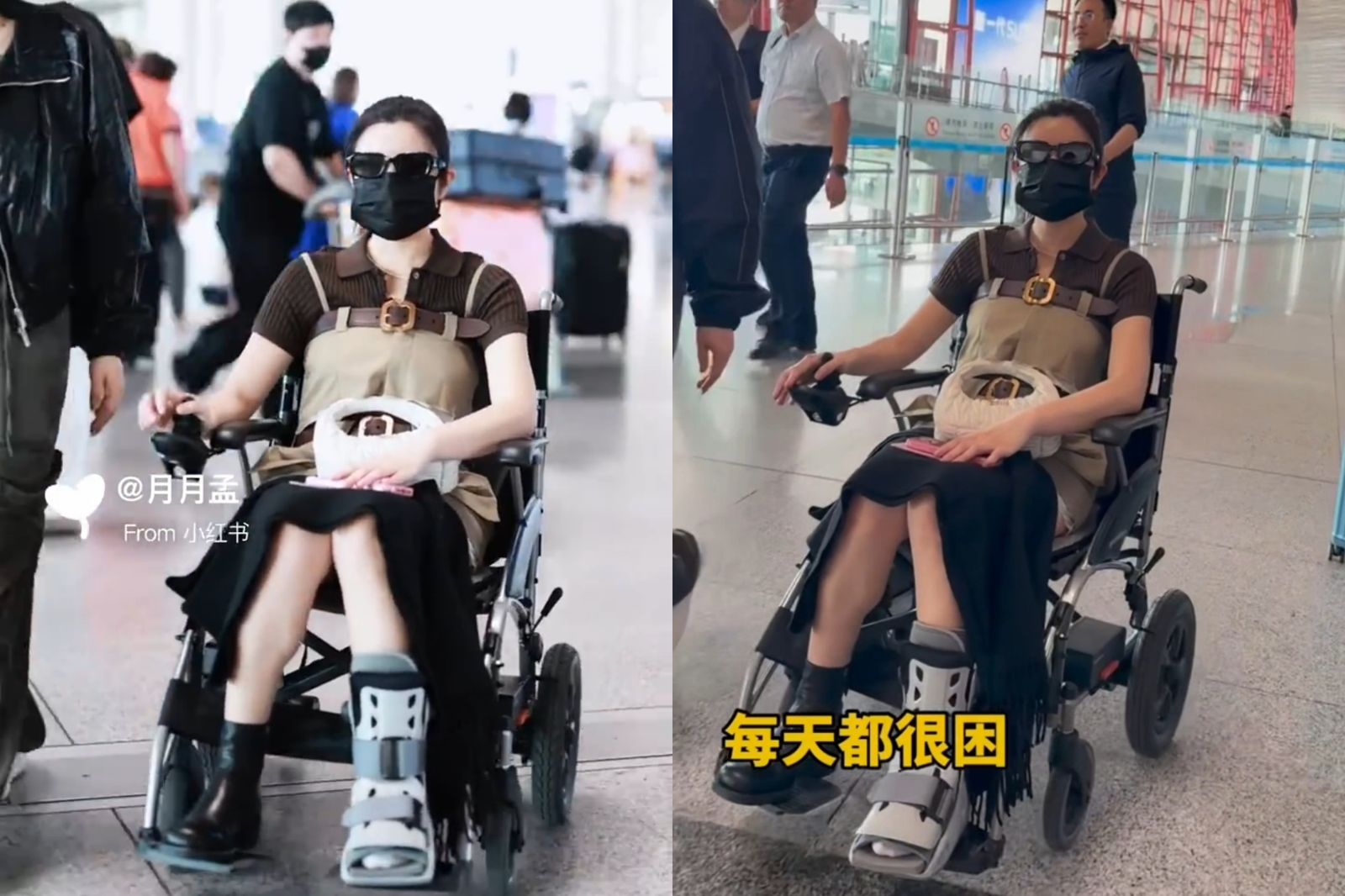 受傷停工2個月!陳妍希素顏「電動輪椅代步」 石膏拆除首露面醫曝復健期「至少半年」