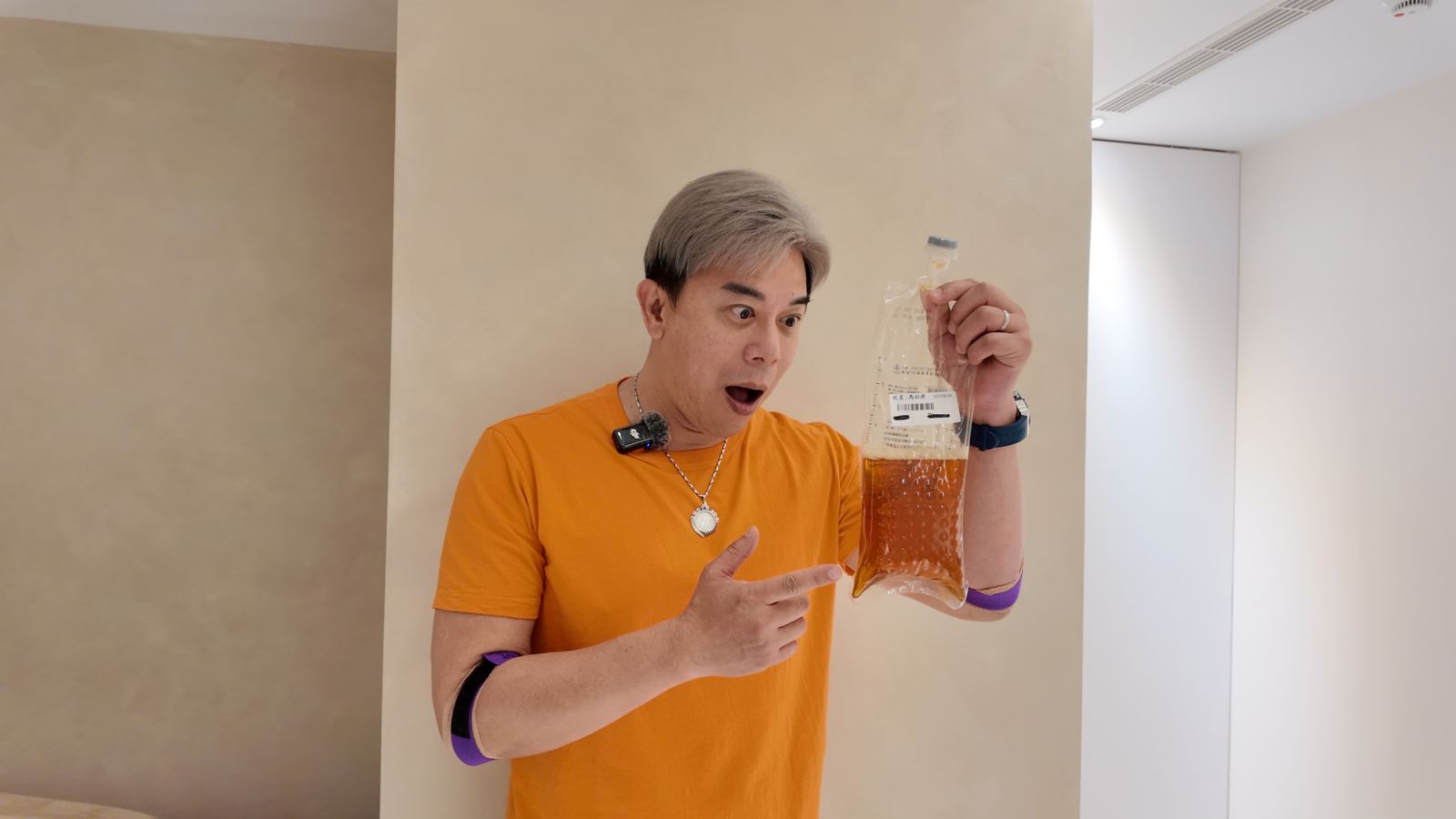 馬幼興見到身體排出的廢液,表情震驚。康博集團提供