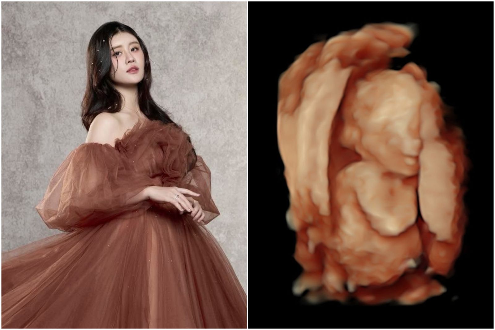 33歲寫真女星懷孕21周心碎引產:哭了很久很久 安胎換成催生「痛到失去意識」...留下寶寶最後紀念