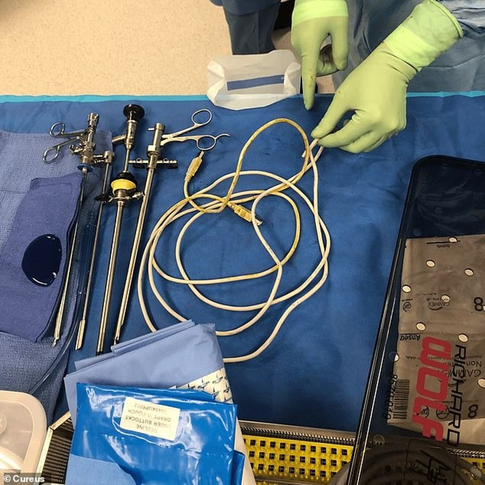 醫師透過手術取出這條USB線。圖/翻自《Cureus》