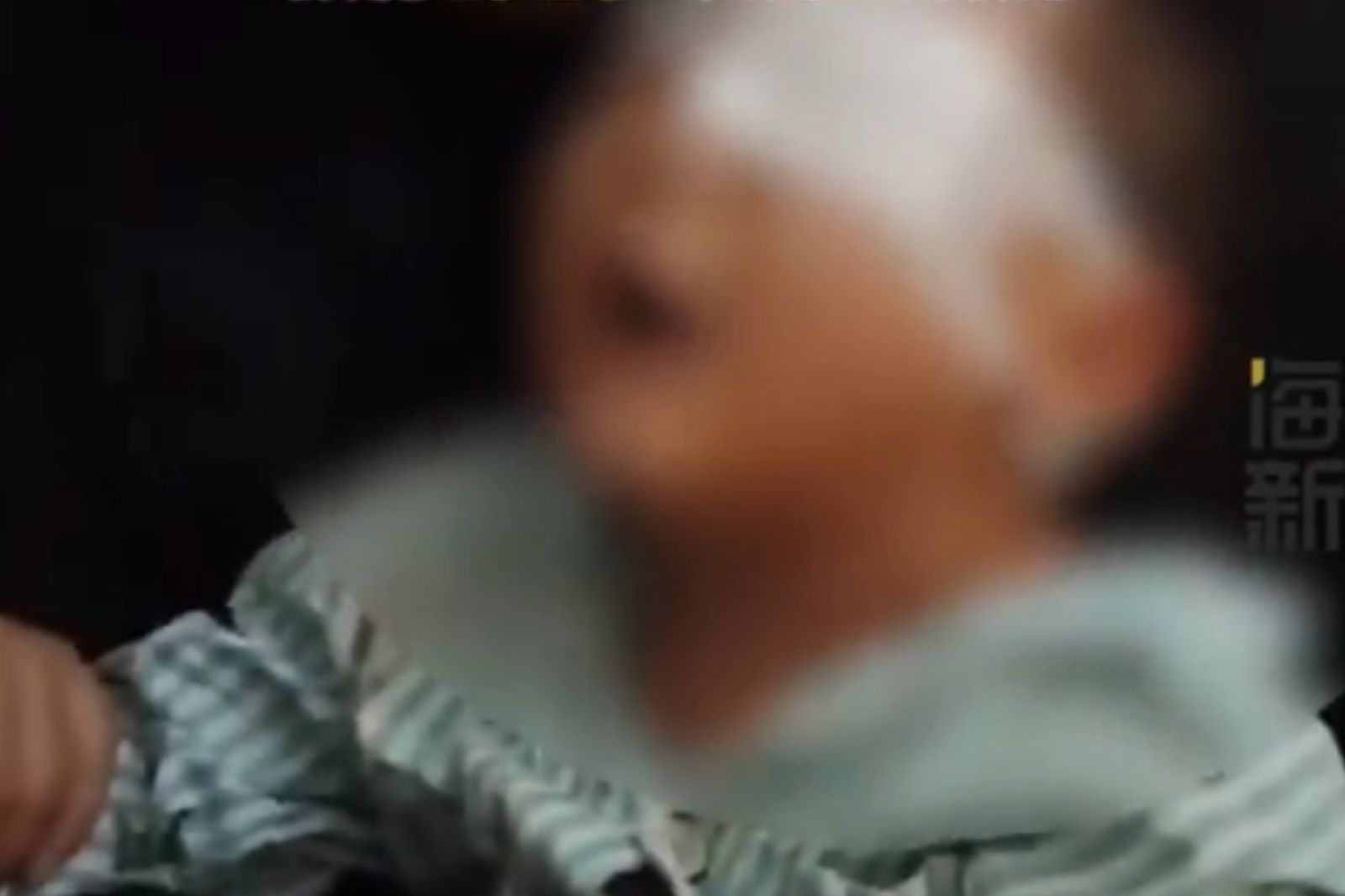 5歲男童「眼睛被戳傷」 老師竟用「豬油」敷眼…下場超慘