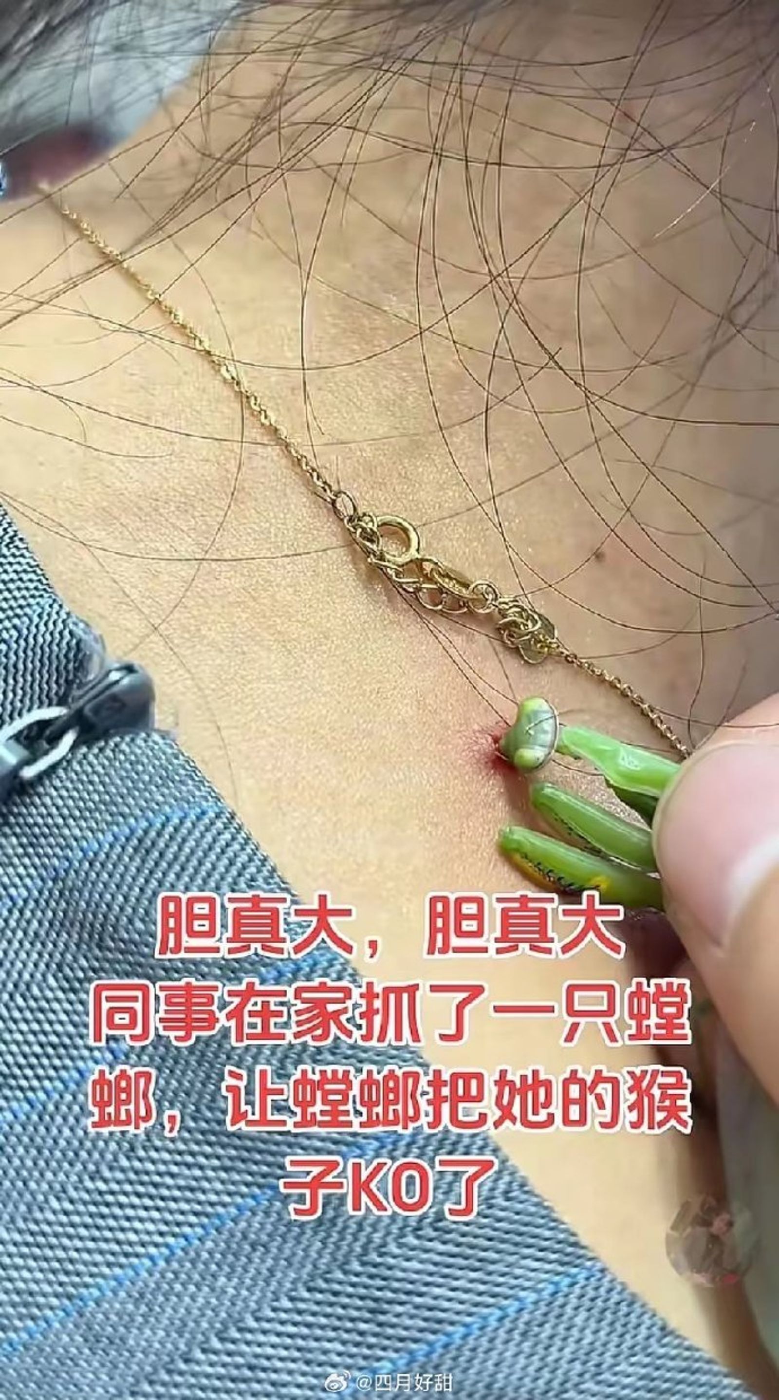 醫學專家指出，讓螳螂啃食肉疣可能引發雙重感染。圖／翻攝自微博