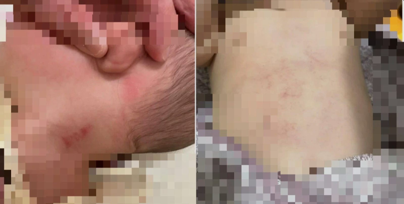 台南惡保母「打飛、重摔」虐6嬰　11月大男嬰腦萎縮...爸媽慟喊：孩子一生毀了