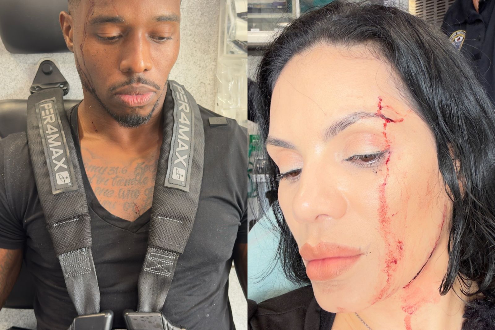 2人臉部、手臂多處割傷。圖／翻攝自IG＠NINAUNRATED