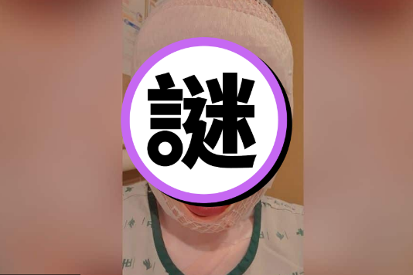 她慘被潑熱水毀容!韓國男稱:變醜就無法離開我