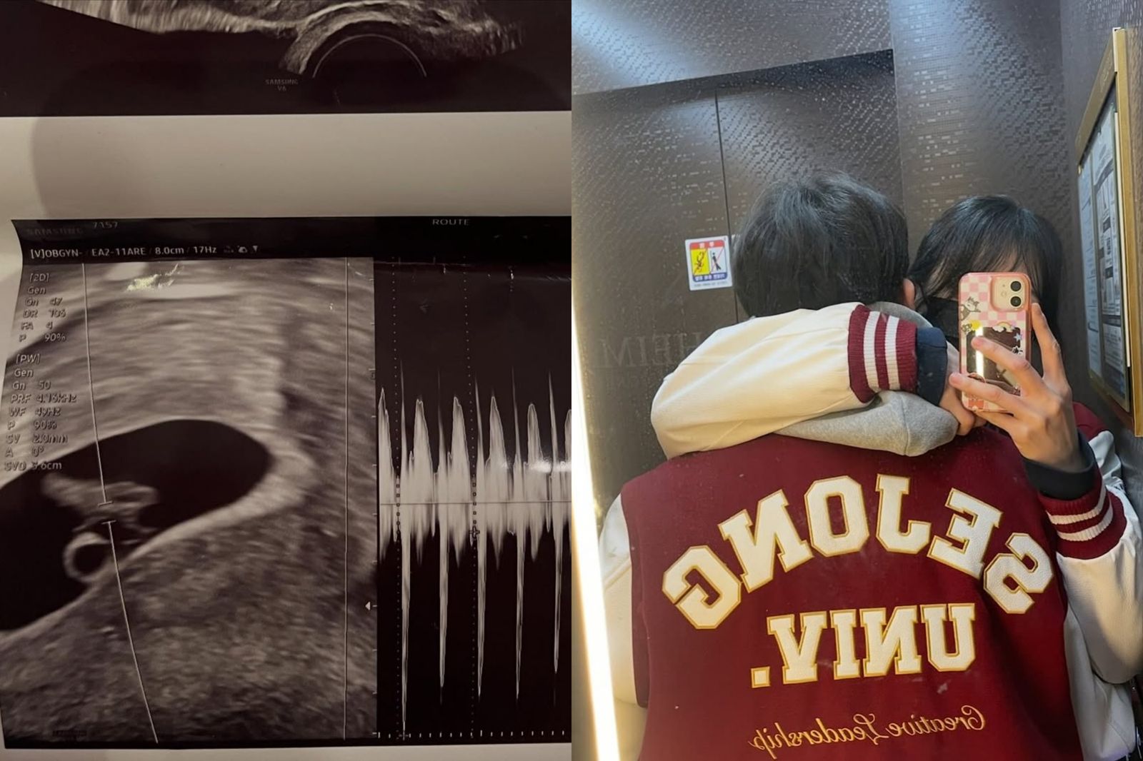 曾與男偶像吸毒！　《Heart Signal 3》理科女神宣告懷孕了