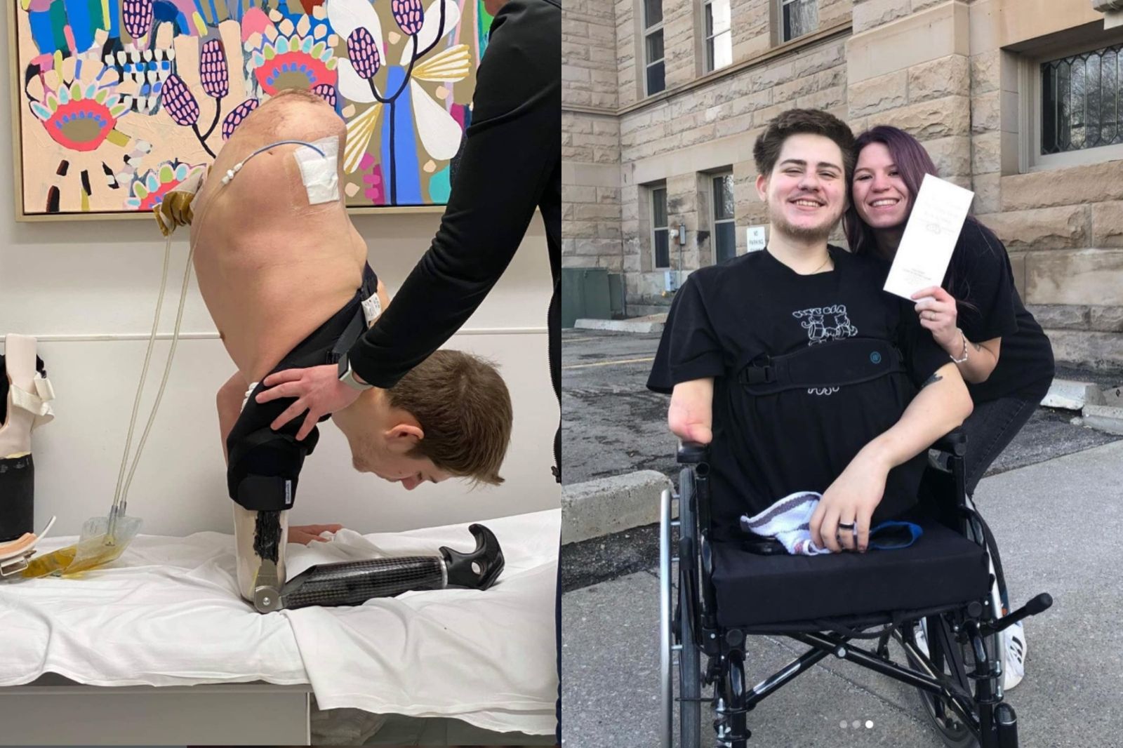 被堆高機「腰斬」下半身全沒！他痛揭家人殘酷真面目：只想湊熱鬧看戲